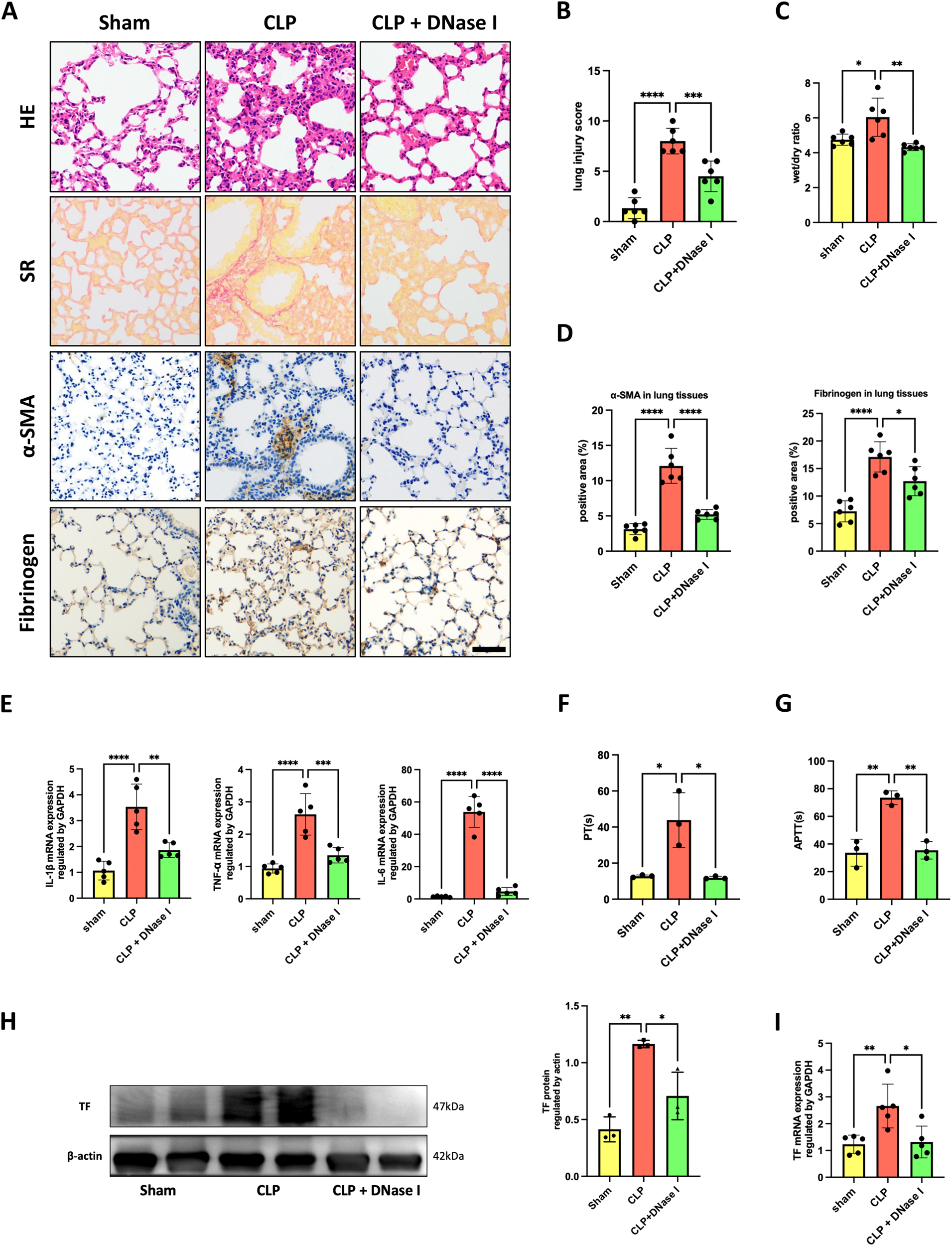 Fig. 2: NET inhibition protected mice against SI-ALI and coagulation activation.