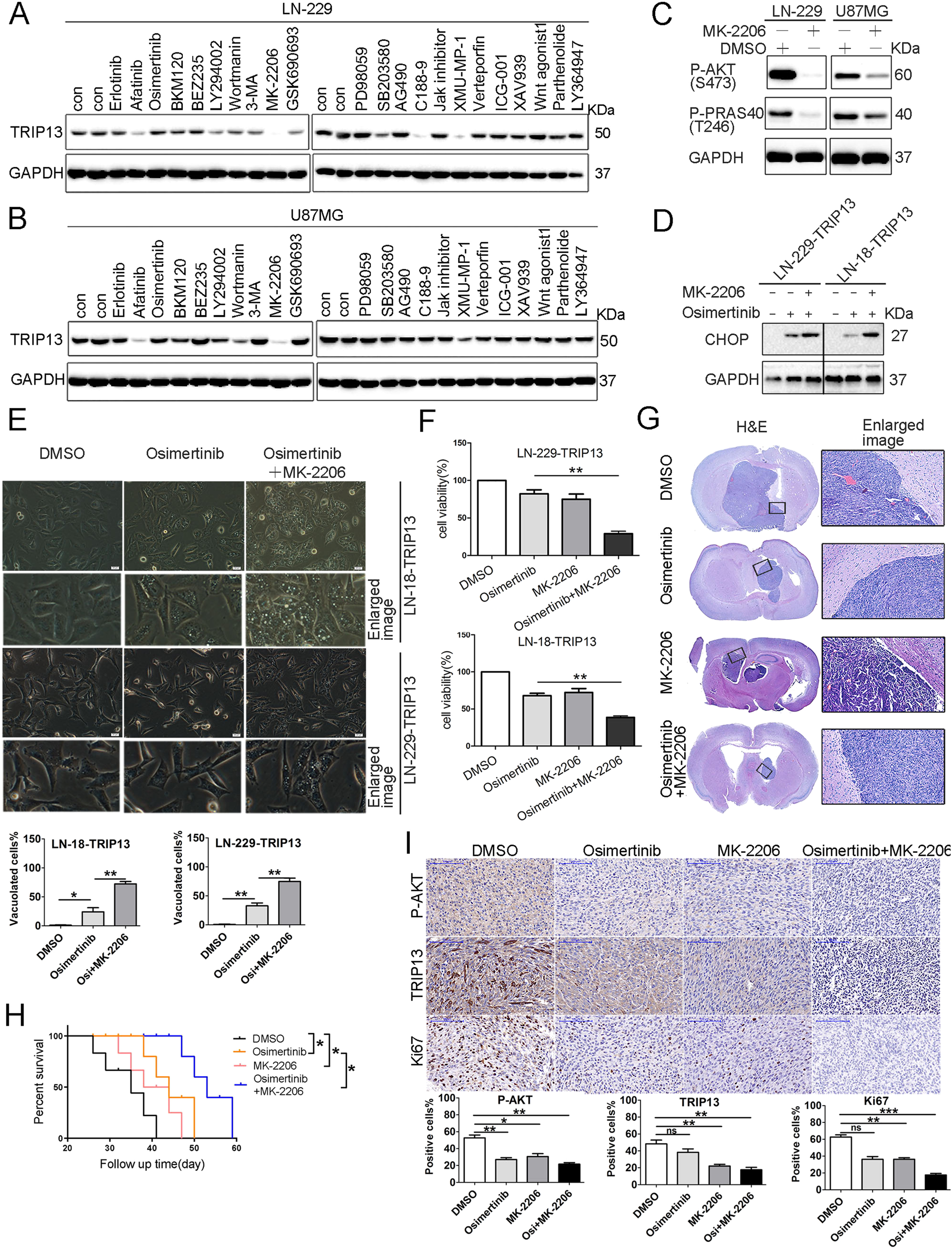 Fig. 5: MK-2206 suppresses TRIP13-overexpressing GBM cell growth.