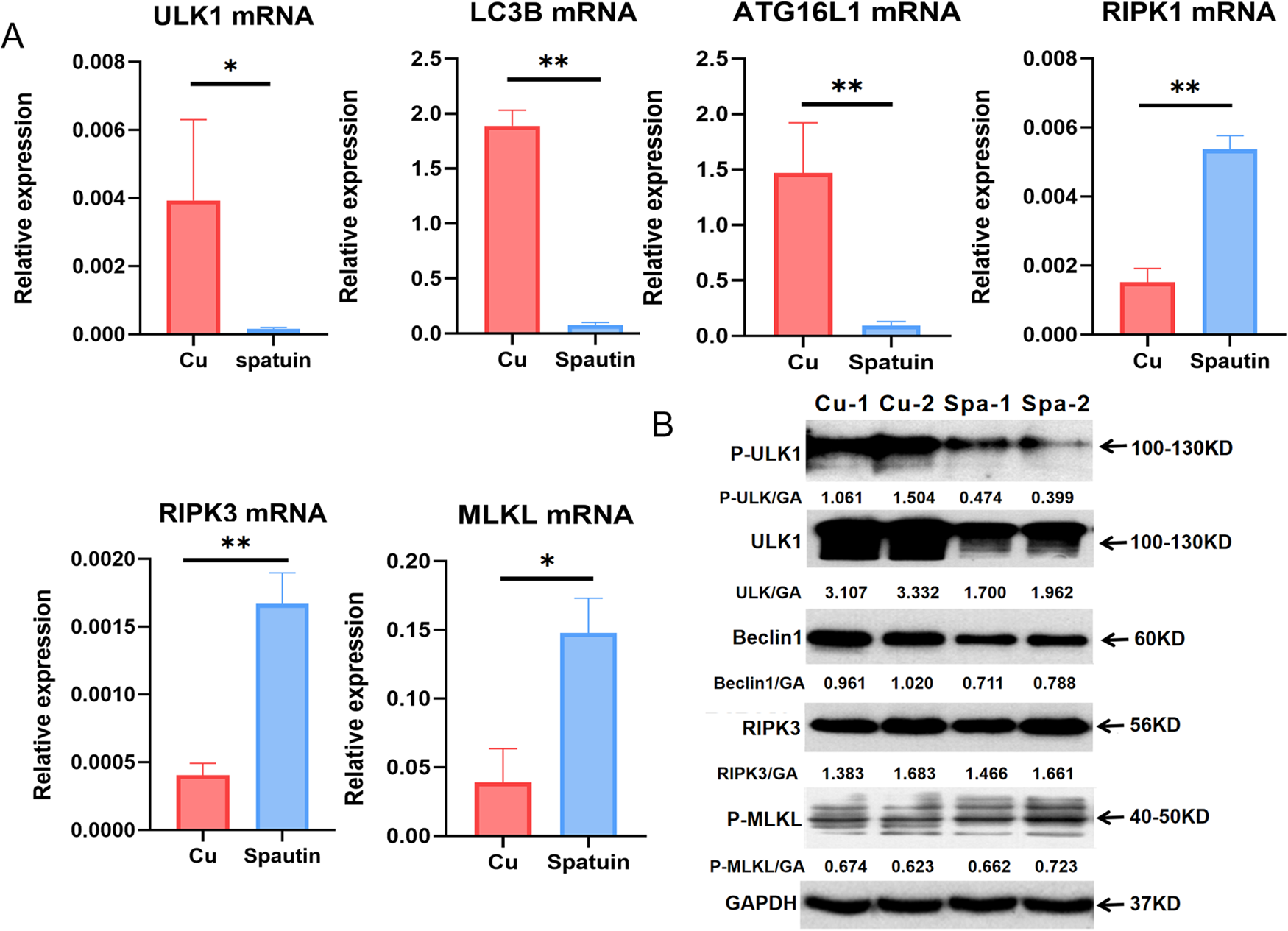 Fig. 5: Autophagy inhibition enhances necroptosis.