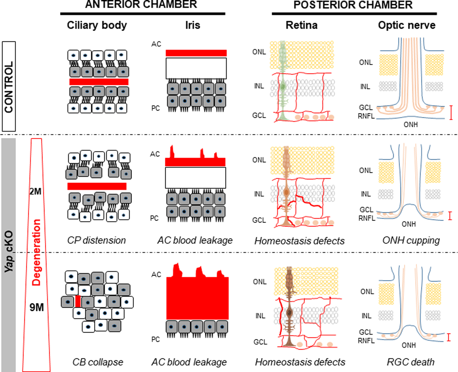 Fig. 8: Uveitic Glaucoma-like features in Yap cKO mice.
