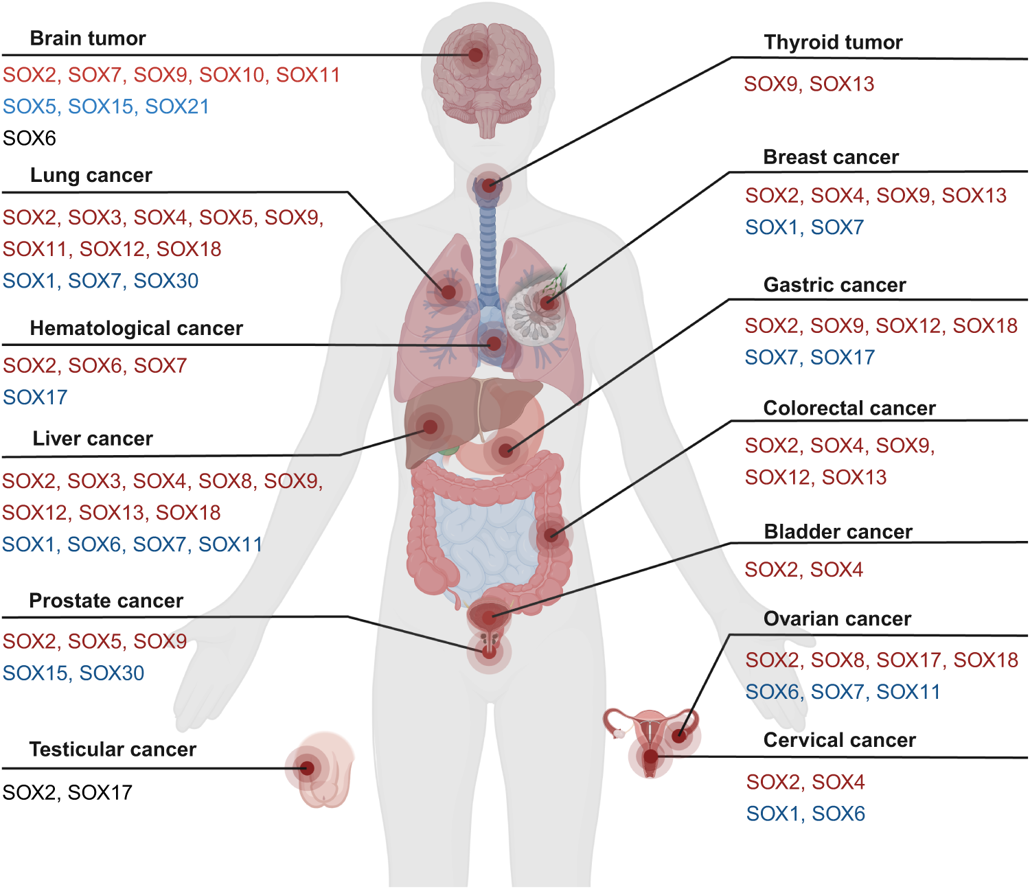 Fig. 3: Involvement of human SOX TFs in cancer.