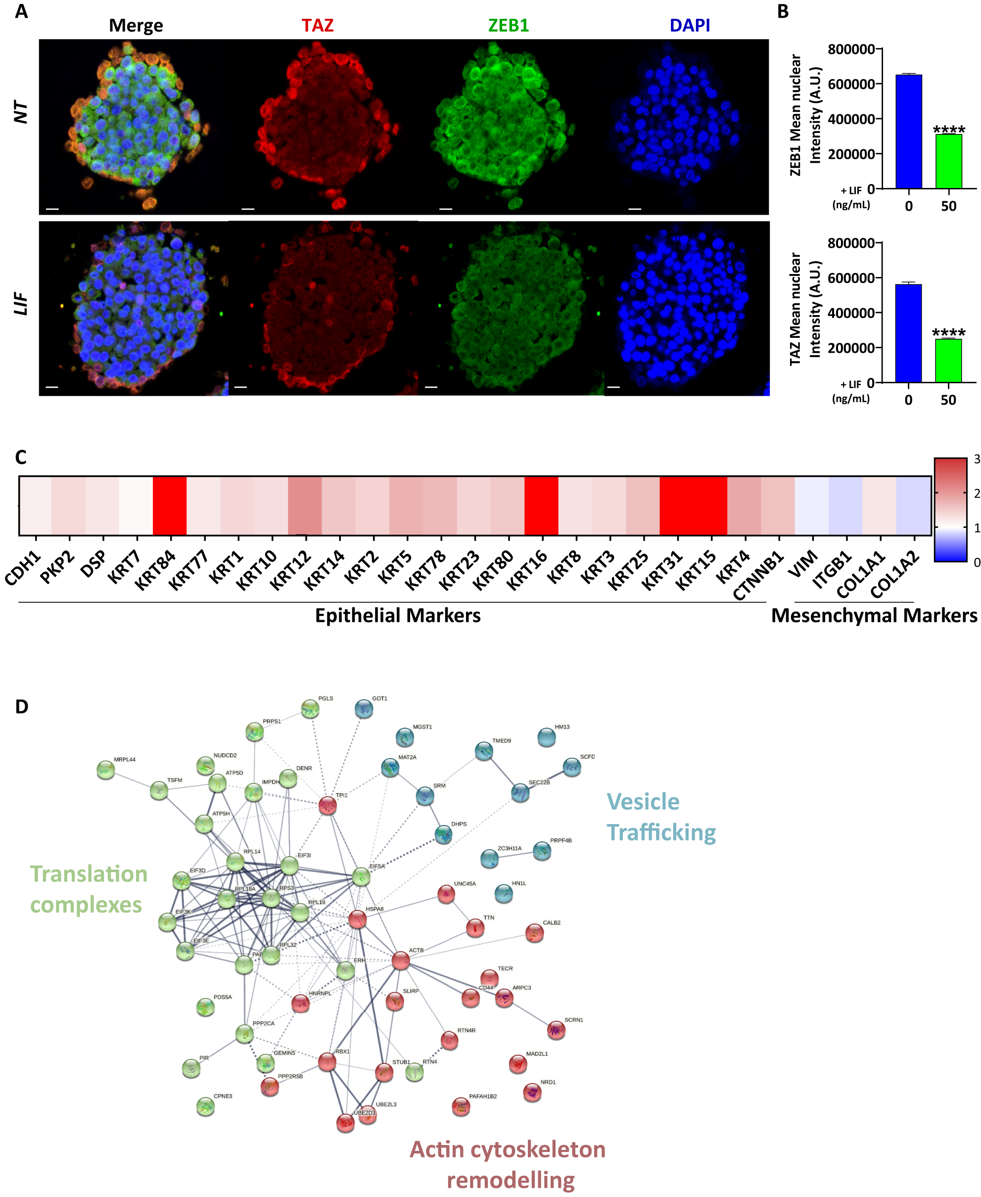 Fig. 4: Leukaemia inhibitory factor decreases EMT markers in invasive gastric CSCs.