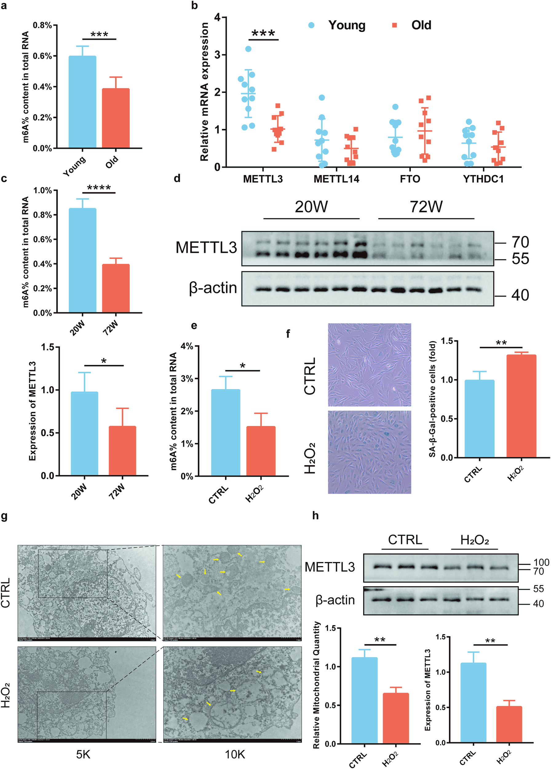 Fig. 1: Diminished m6A modification in osteoporosis in the elderly.