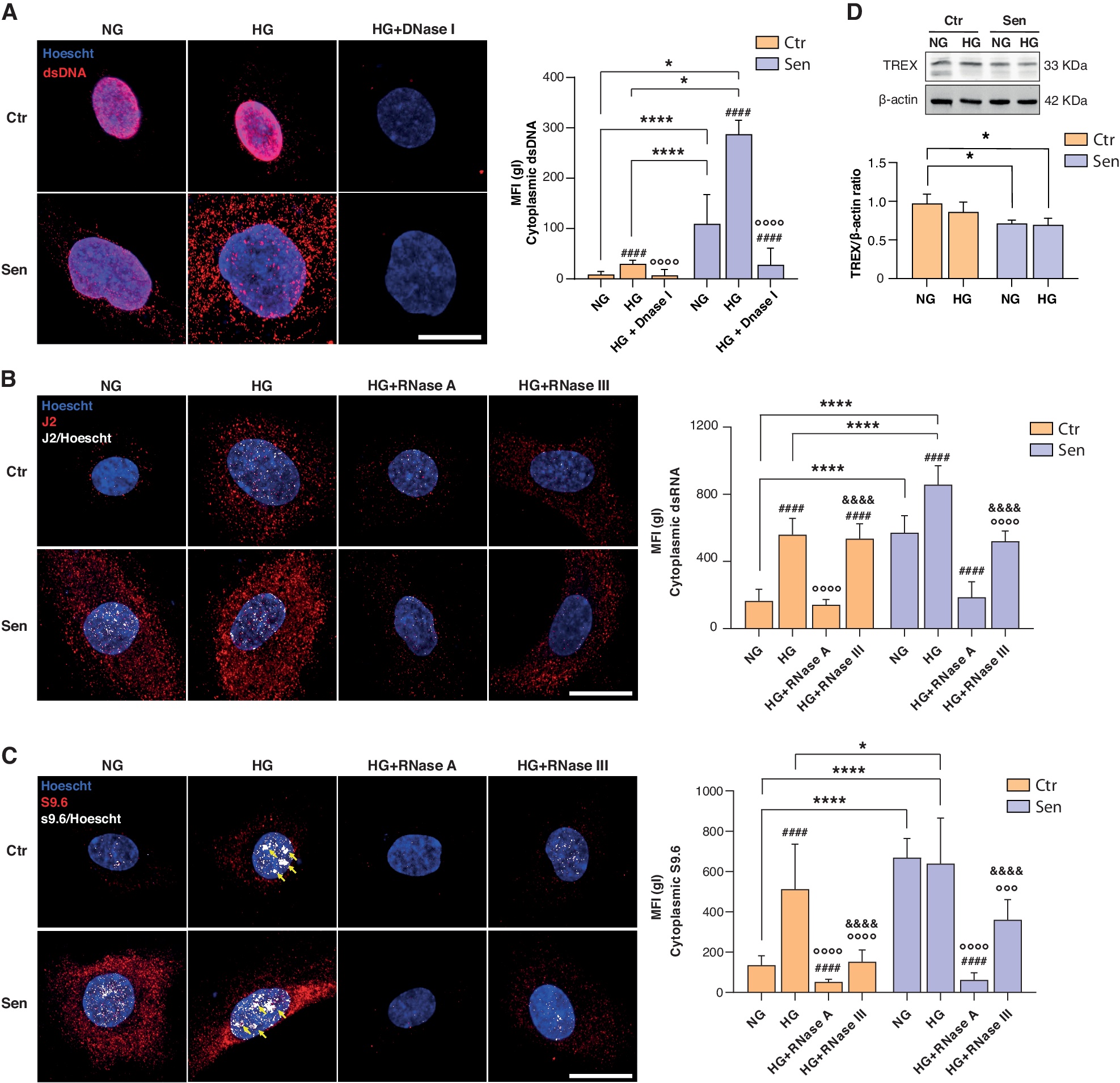 Fig. 4: High glucose-treated cells and senescent cells accumulate cytoplasmic self-derived nucleic acids.
