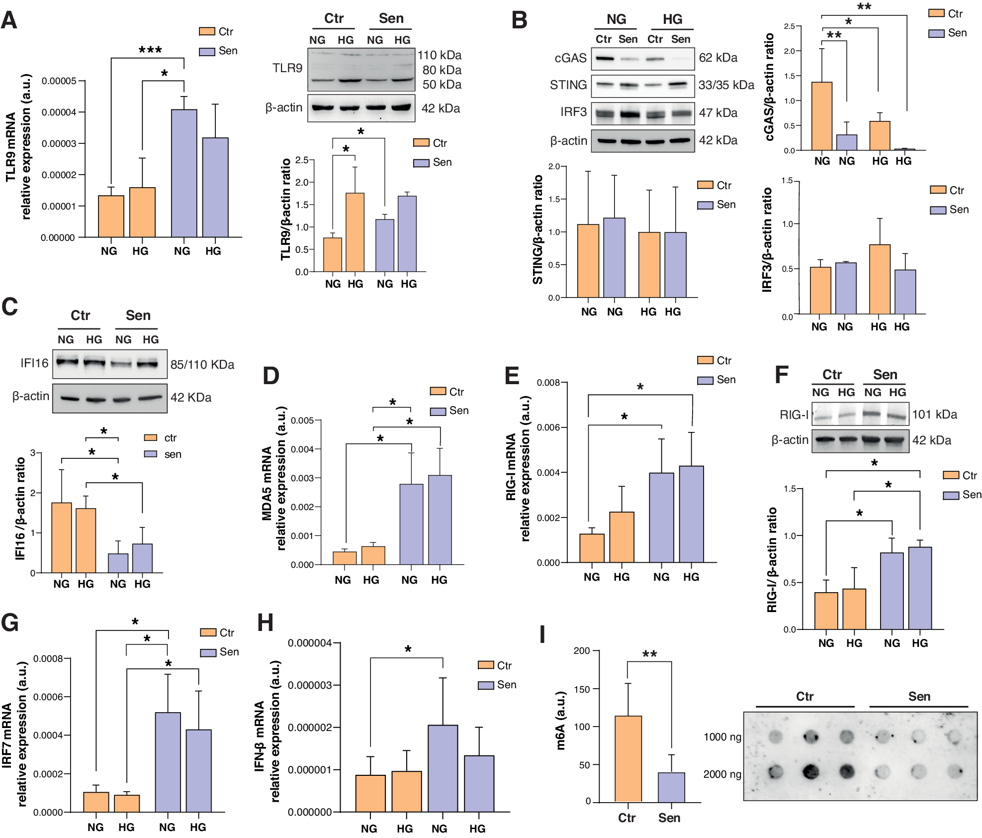 Fig. 5: Cytosolic RNA sensors are upregulated in high glucose-treated and senescent HUVECs.