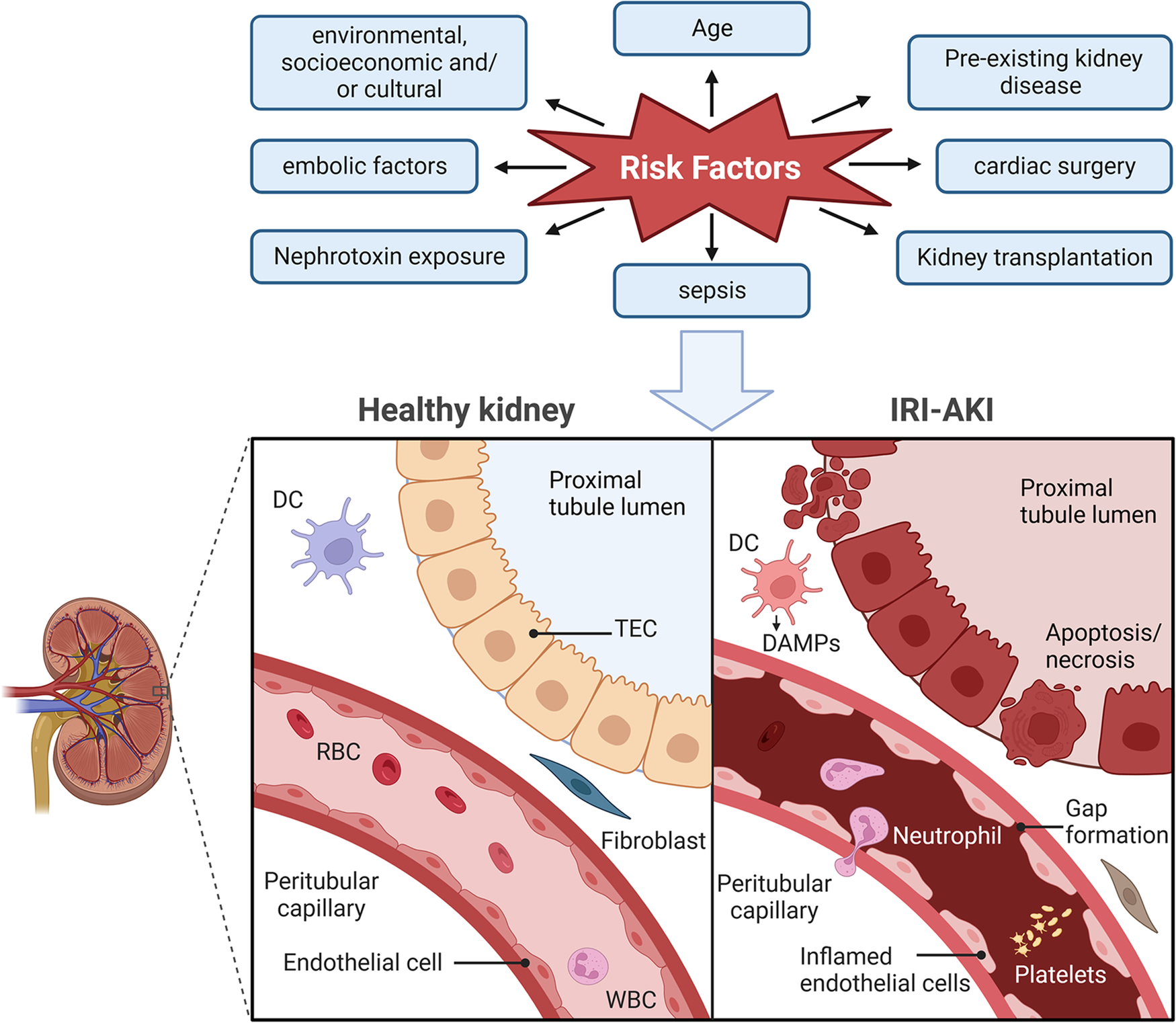 Fig. 1: Human kidney biopsy with IRI-AKI (cortical area).