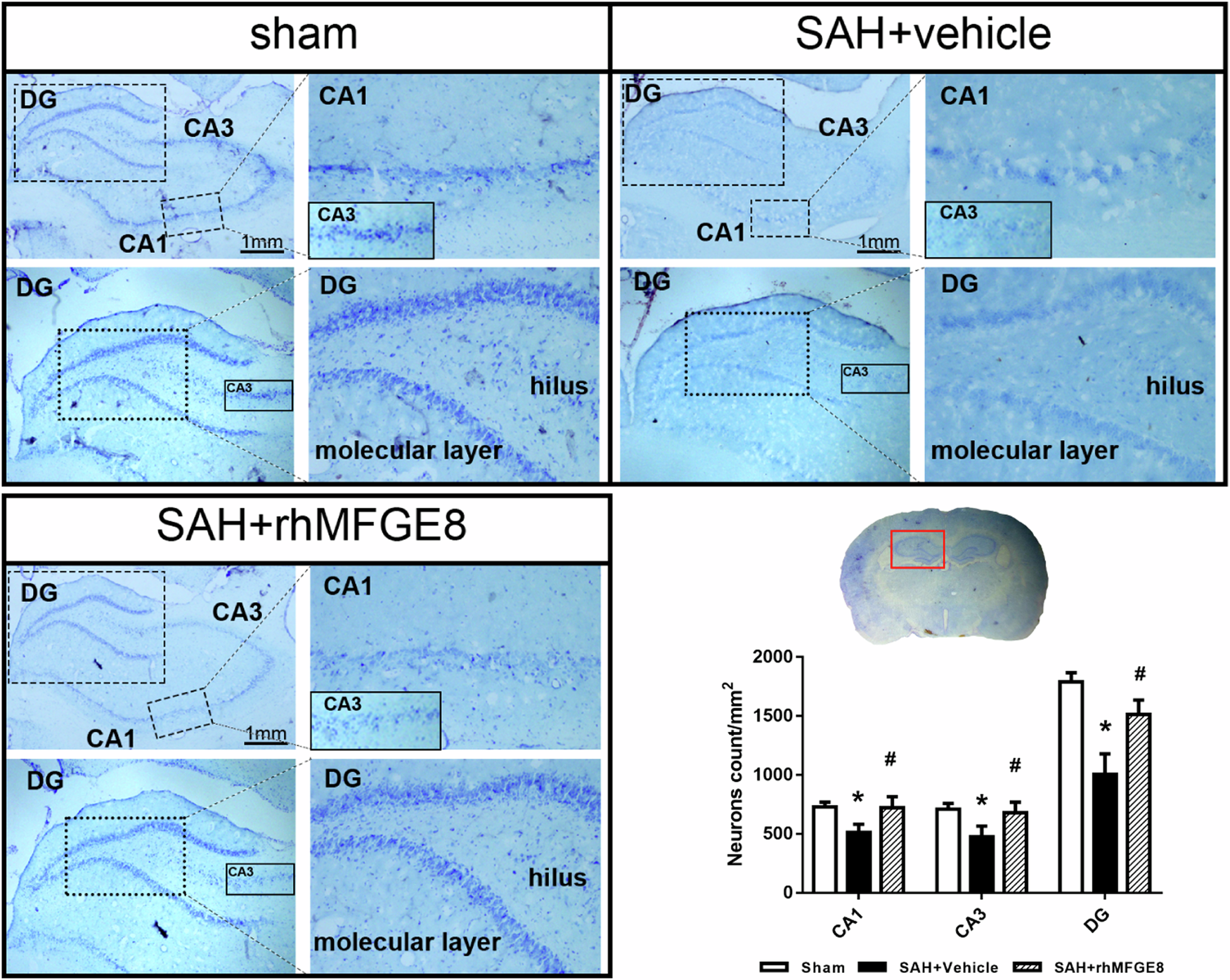 Fig. 8: Administration of rhMFGE8 attenuated hippocampal injury after SAH.