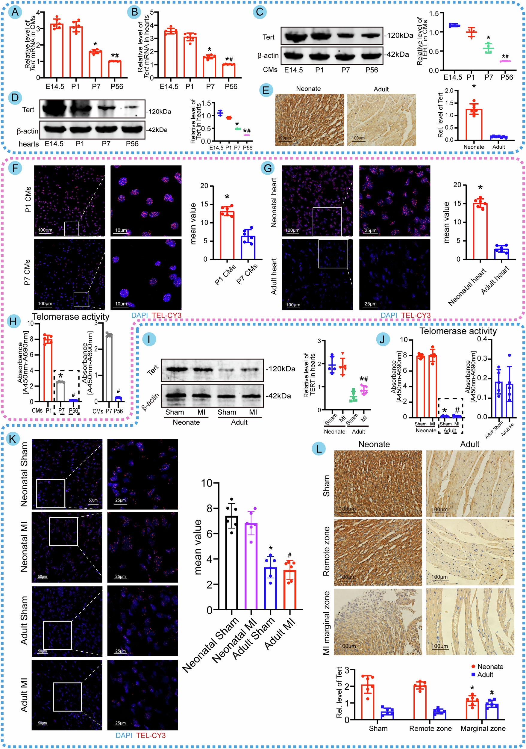 Fig. 1: Tert, telomere, and telomerase activity characterize cardiac development and cardiac repair after myocardial infarction.