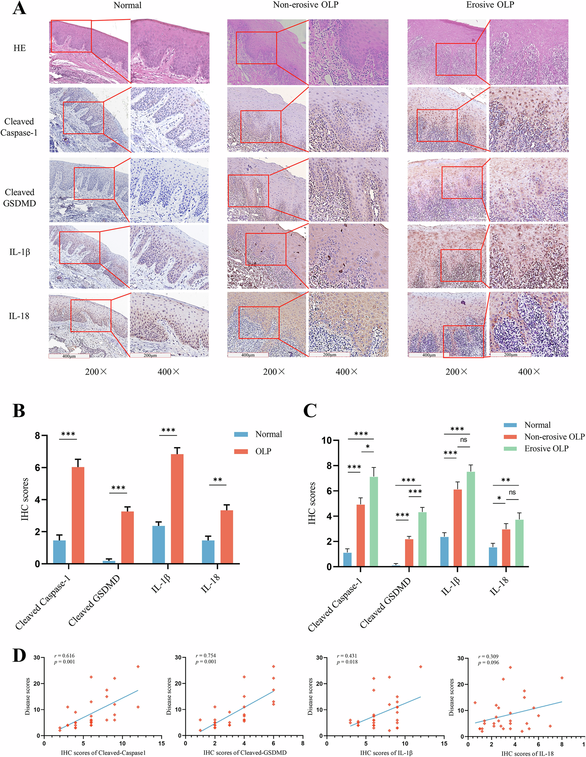 Fig. 1: Increased expression of pyroptosis-related proteins in OLP oral epithelial tissues is closely related to the severity of patients’ conditions.