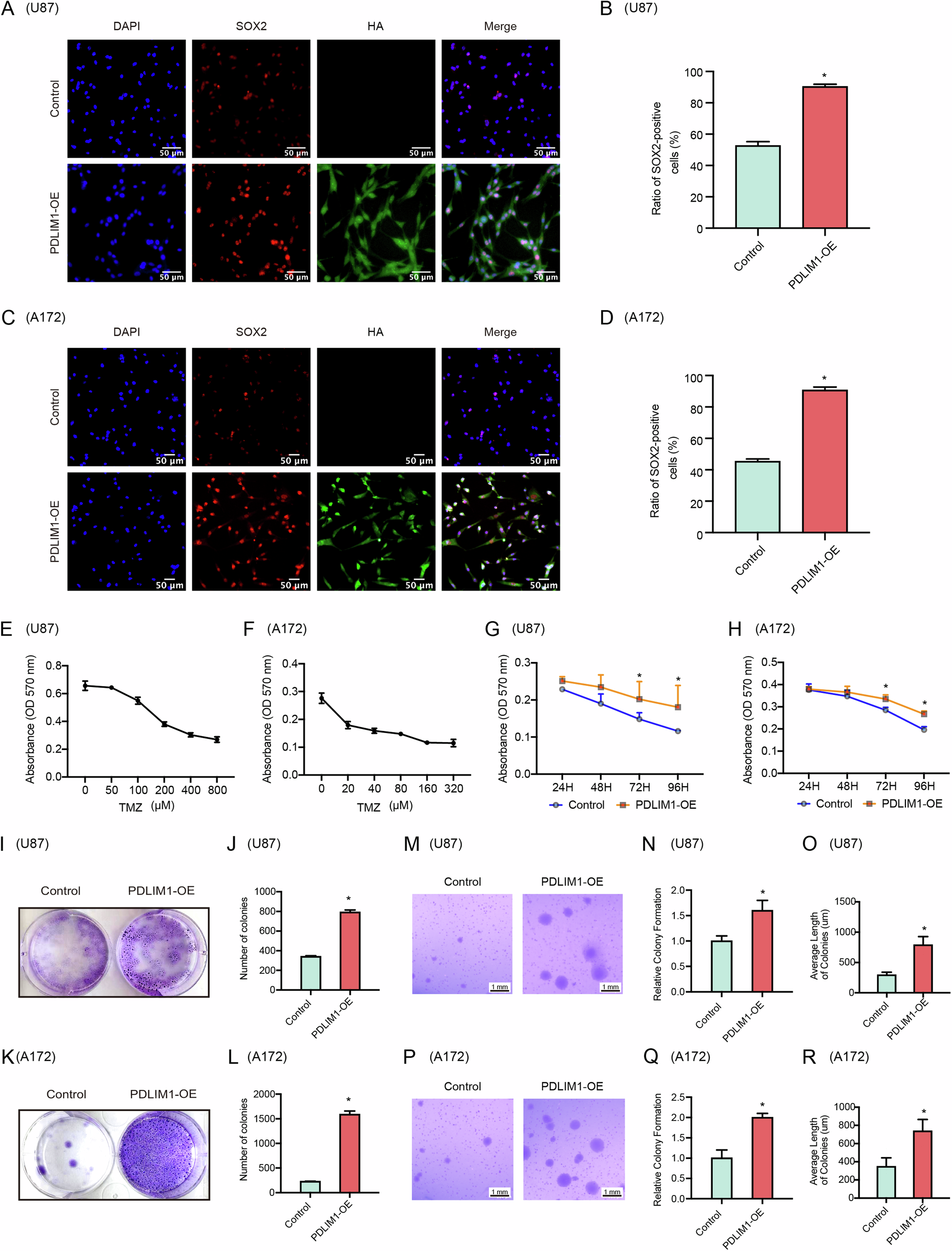 Fig. 4: PDLIM1 overexpression promoted GSC-mediated processes.