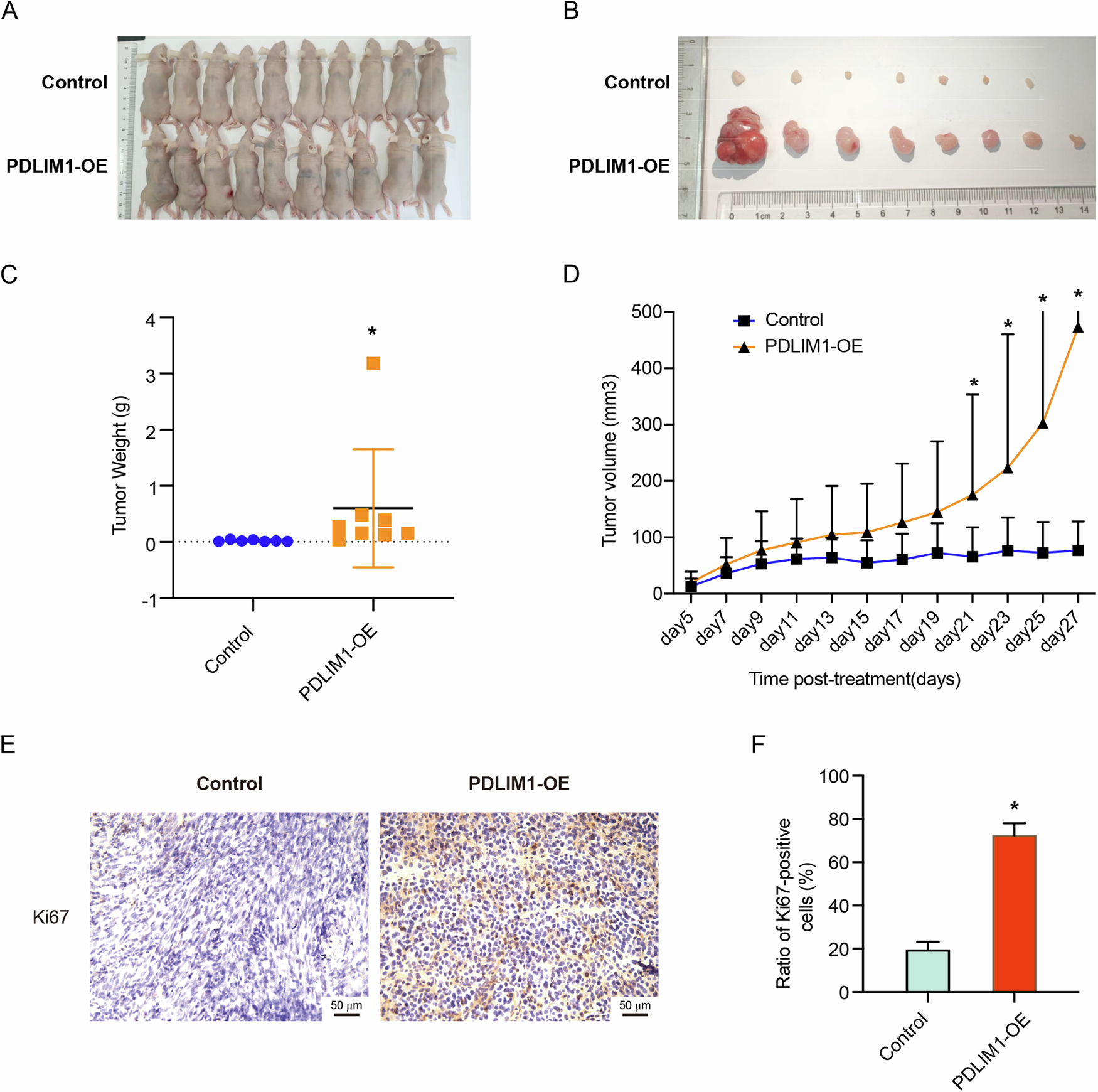 Fig. 5: PDLIM1 overexpression promoted tumorigenesis in xenograft mice.