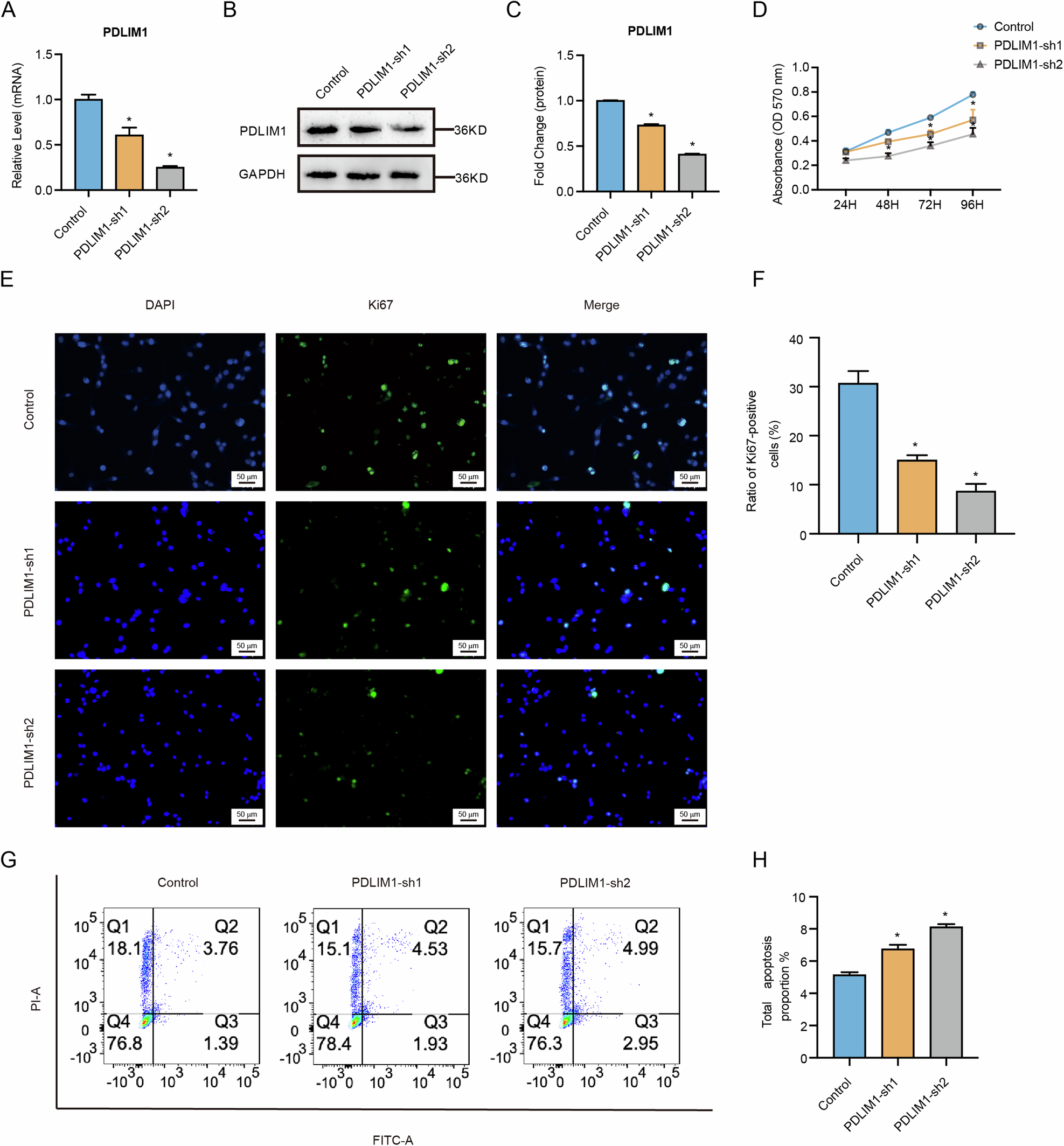 Fig. 6: PDLIM1 knockdown inhibited GBM progression.