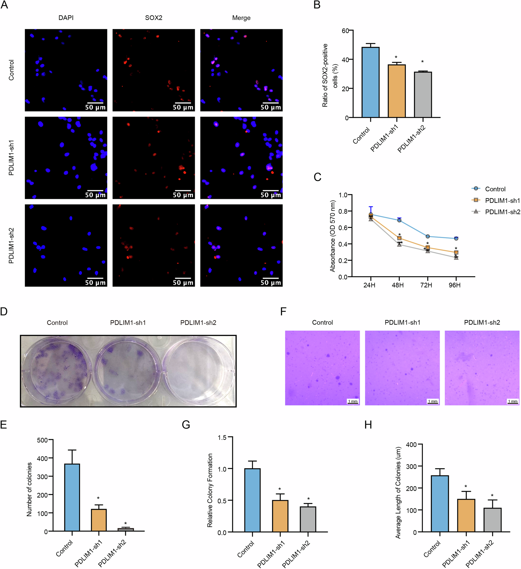 Fig. 7: PDLIM1 knockdown inhibited GSC-mediated processes.