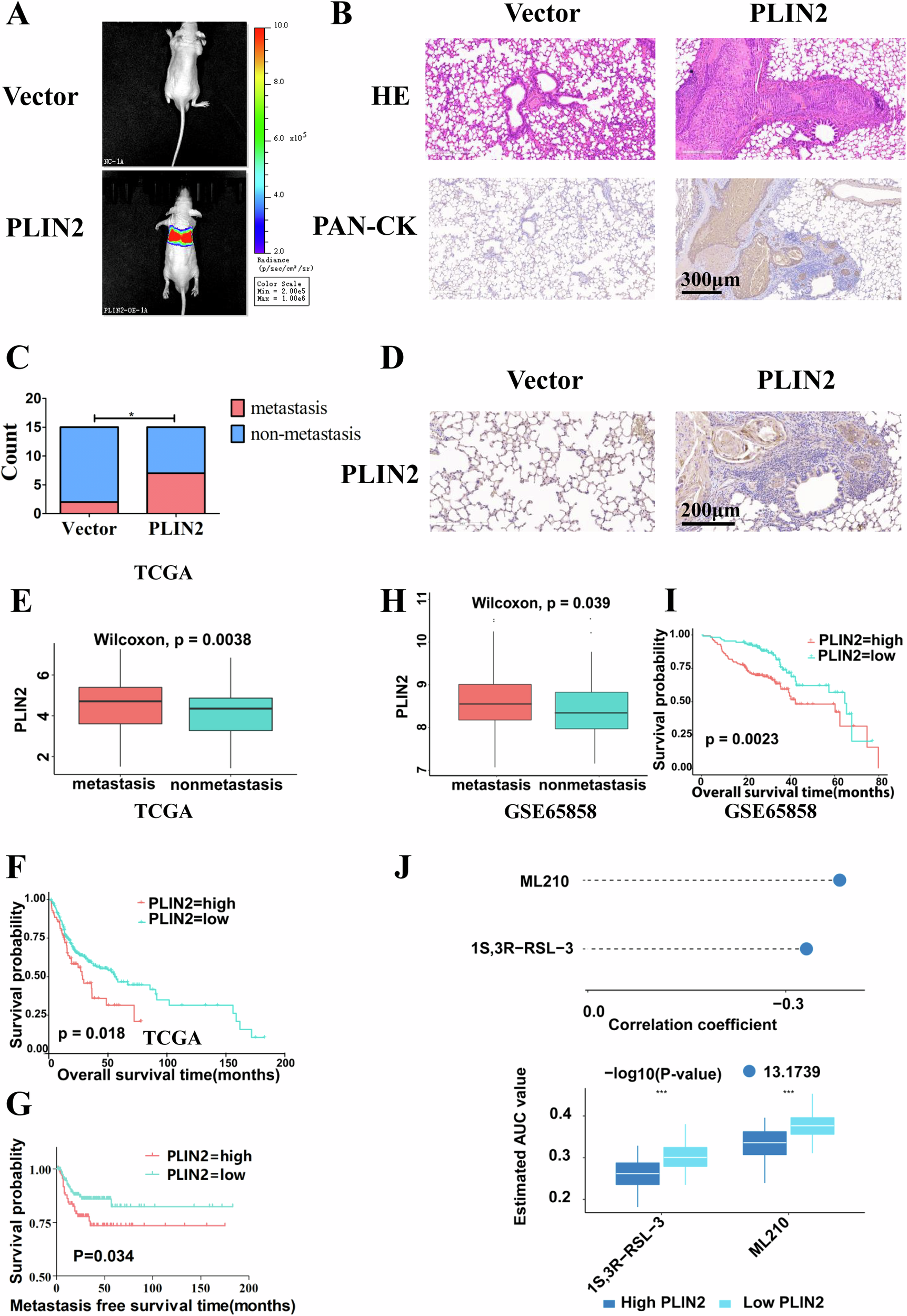 Fig. 5: Upregulation of PLIN2 accelerates in vivo metastasis of OSCC cells and predicts poor prognosis of OSCC patients.