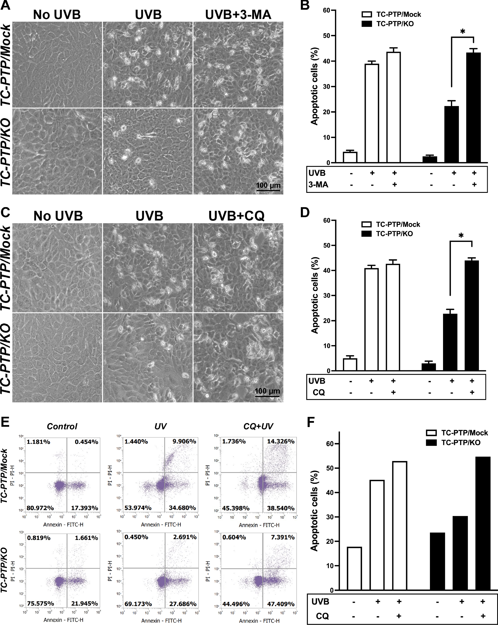 Fig. 5: Inhibition of autophagy on the regulation of UVB-induced apoptosis in keratinocytes.
