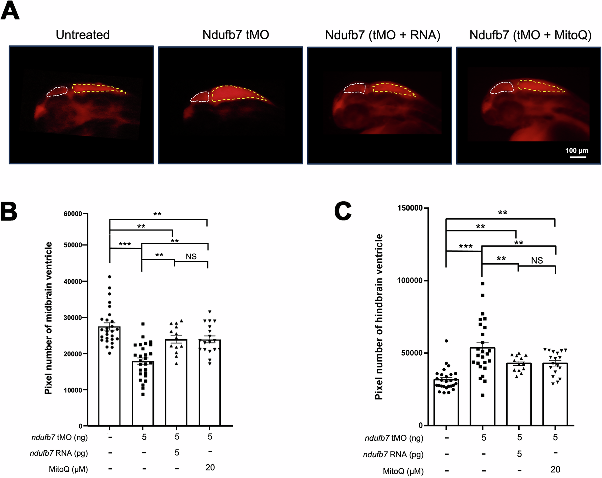 Fig. 4: Knockdown of Ndufb7 changes the sizes of brain ventricles revealed by dextran rhodamine injection.