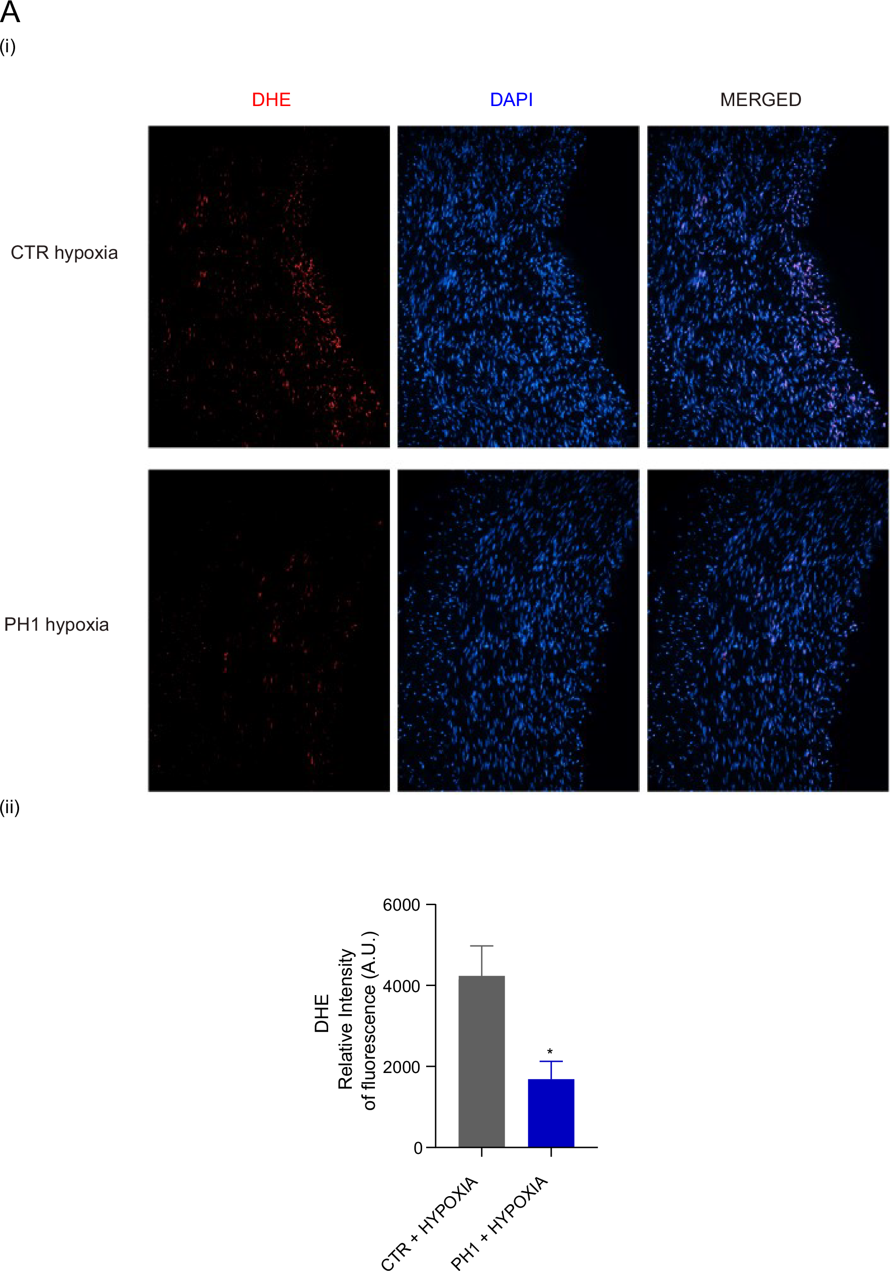 Fig. 3: PH1 reduces vascular ROS in hypoxia.