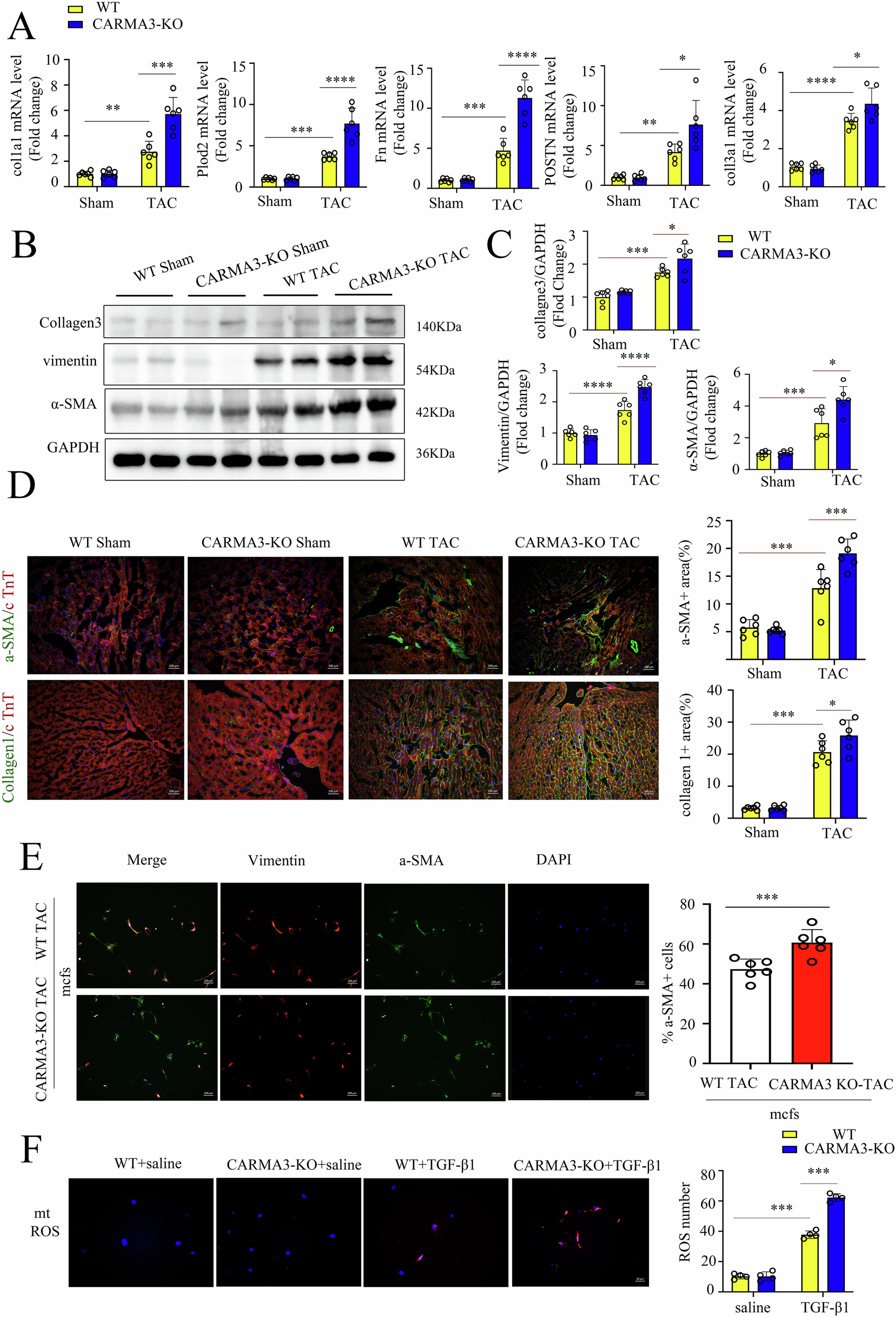 Fig. 3: CARMA3 deficiency promotes myofibroblast activation under pressure overload.