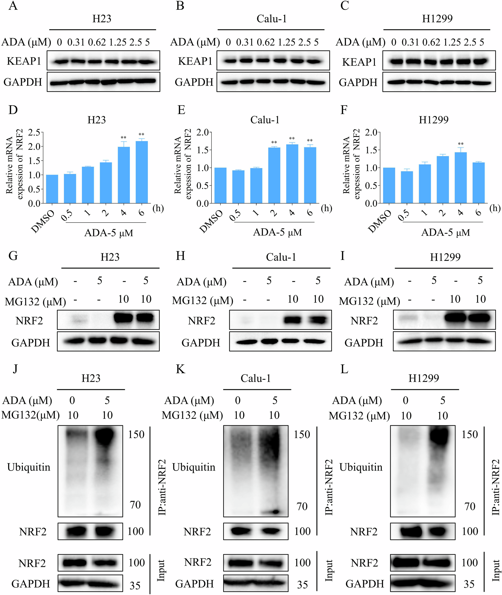 Fig. 3: ADA treatment promoted the ubiquitination of NRF2 in NSCLC cells.