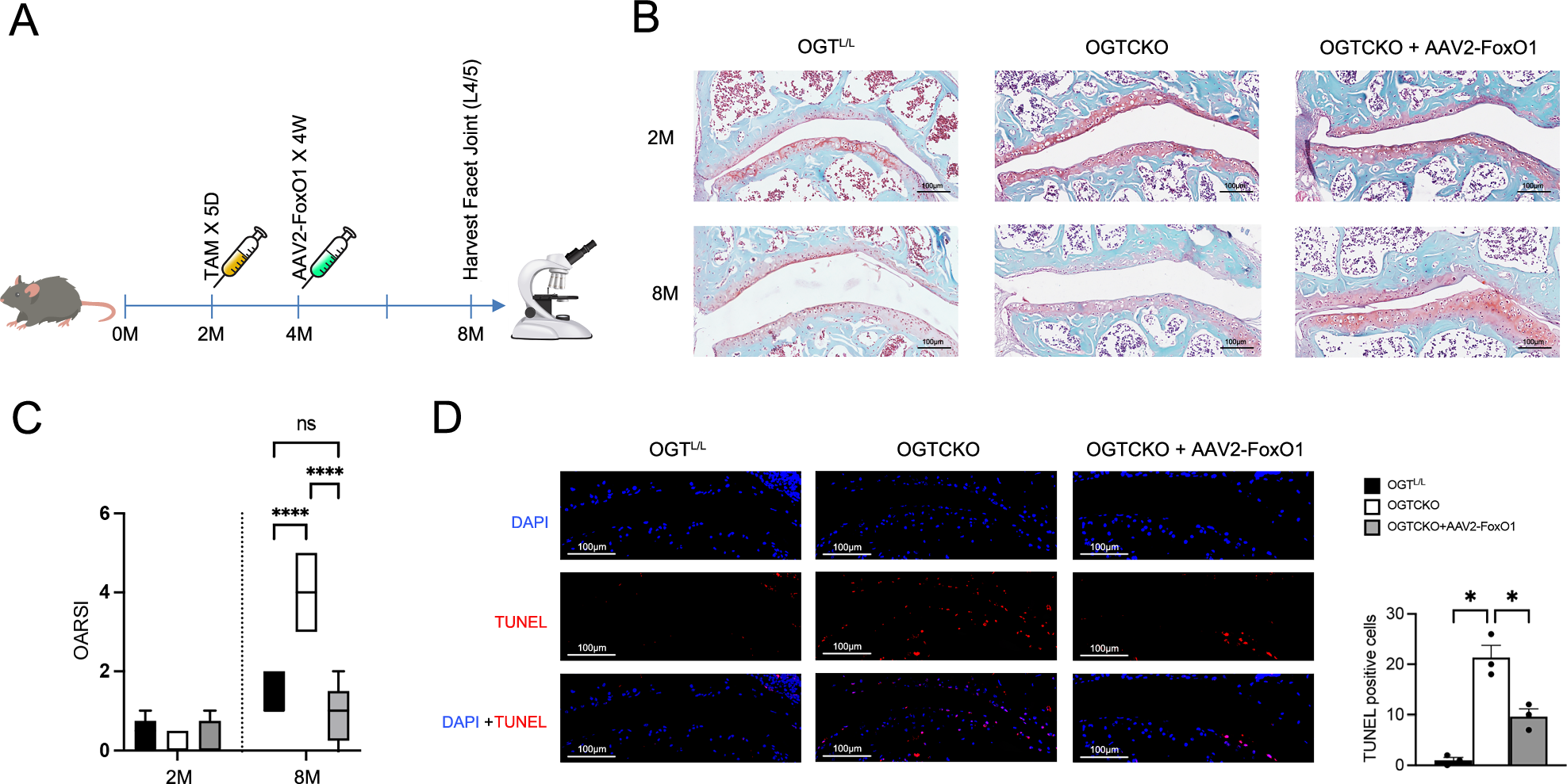 Fig. 5: AAV2-FoxO1 mitigates FJOA progression and chondrocyte apoptosis in OGT knockout mice.