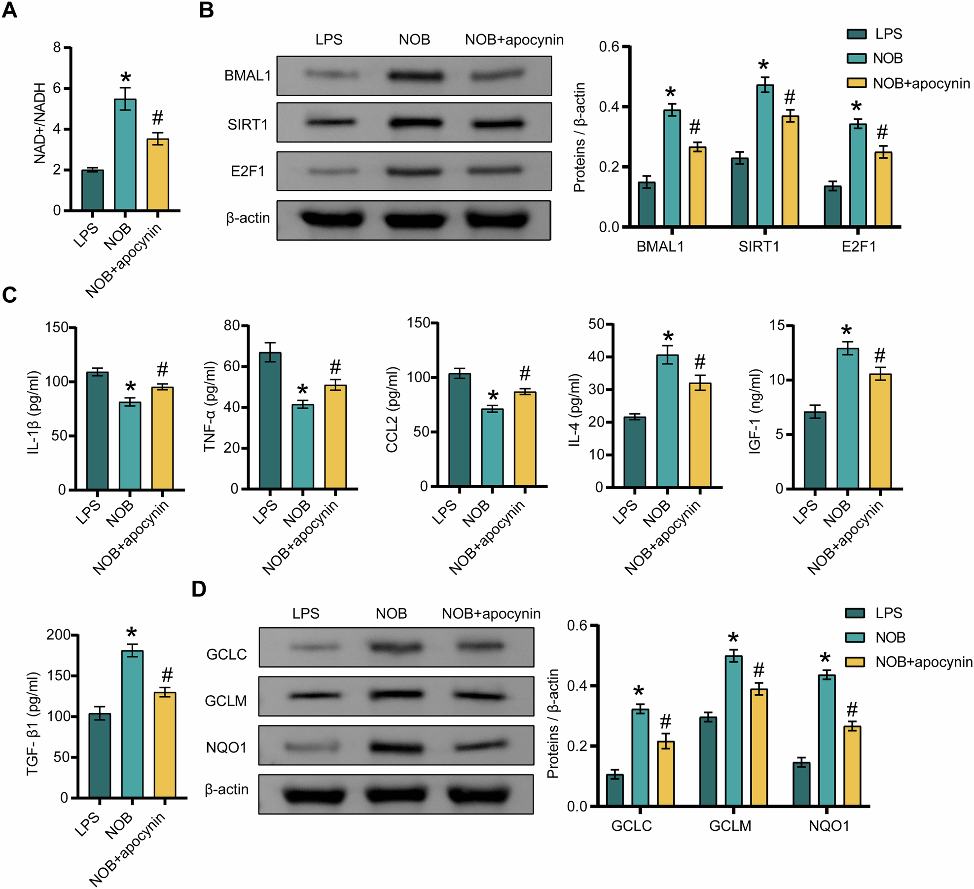 Fig. 3: NAD+ metabolism is involved in the regulation of NOB nanoparticles-mediated inflammation, oxidative stress, and BMAL1/SIRT1/E2F1 pathway in the presence of LPS.