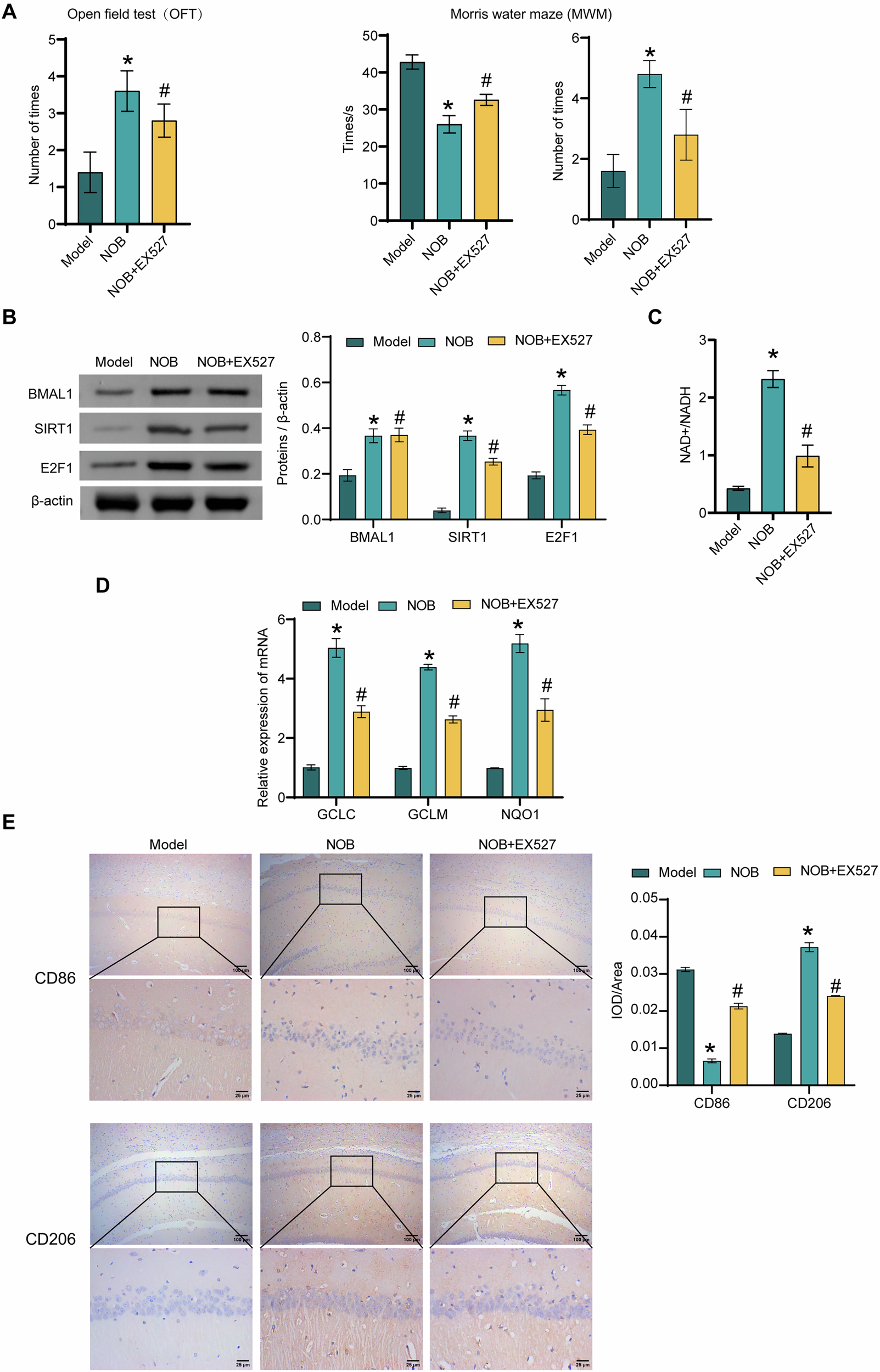 Fig. 6: NOB nanoparticles ameliorate chronic PSD-induced cognitive deficits and microglia polarization in rats through activation of SIRT1.