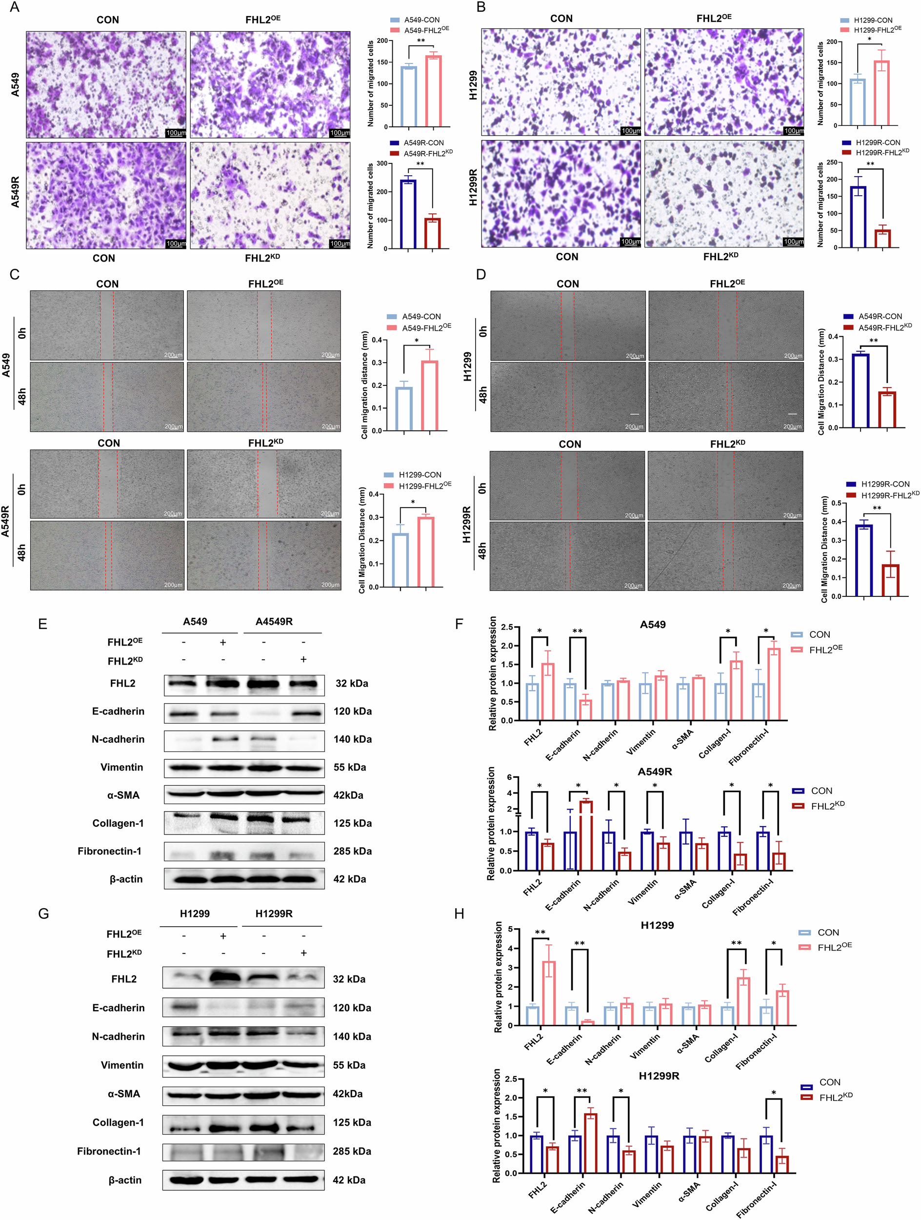 Fig. 3: FHL2 promotes ECM deposition and EMT phenotype in NSCLC cells.