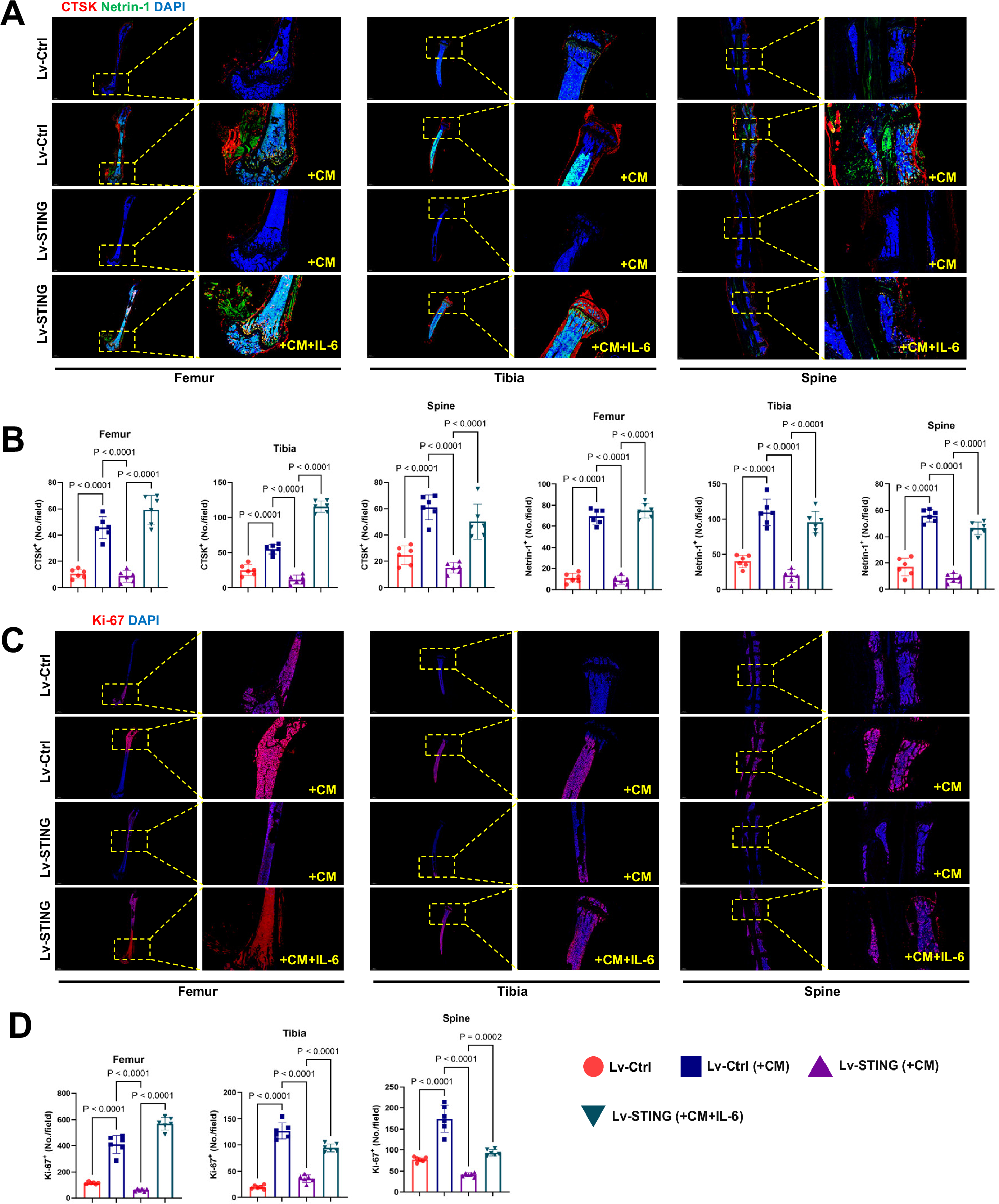 Fig. 7: Hijacking of STING expression in tumor cells by IL-6/STAT3 inhibits OPN formation and bone destruction.