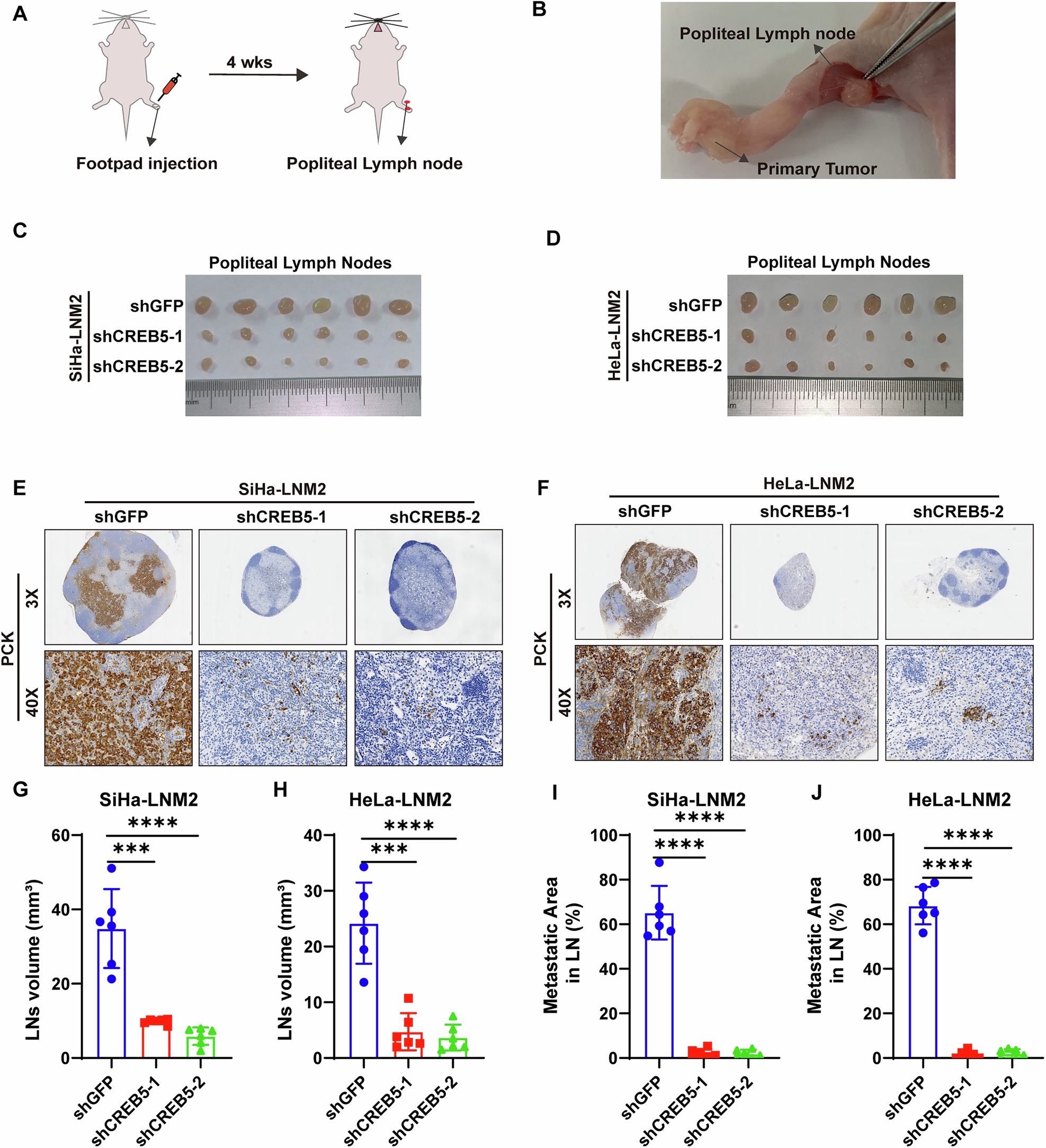 Fig. 2: CREB5 drives lymph node metastasis of CCa in vivo.