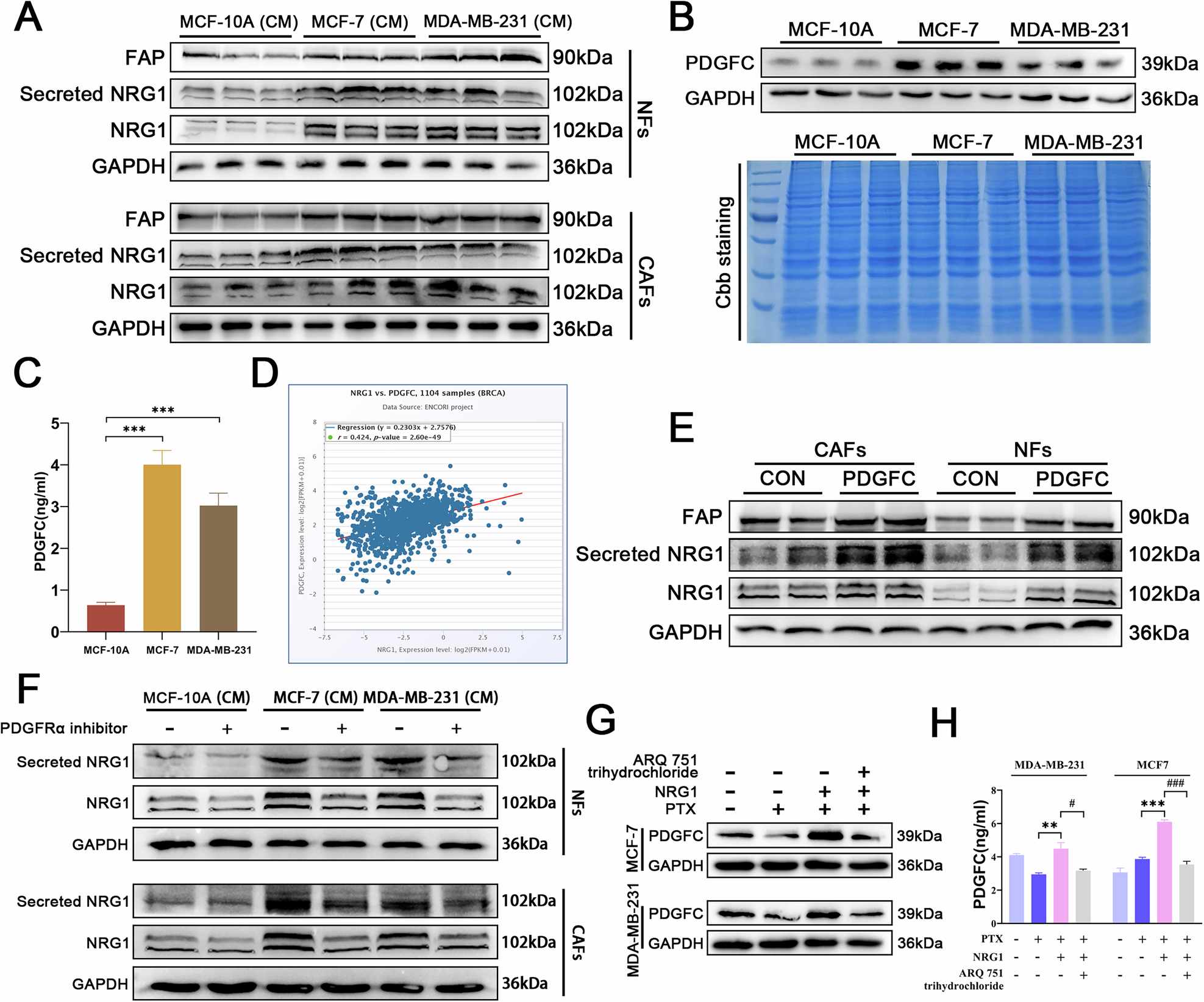 Fig. 5: PDGFC from BC cells forms a positive feedback loop with CAFs-derived NRG1.