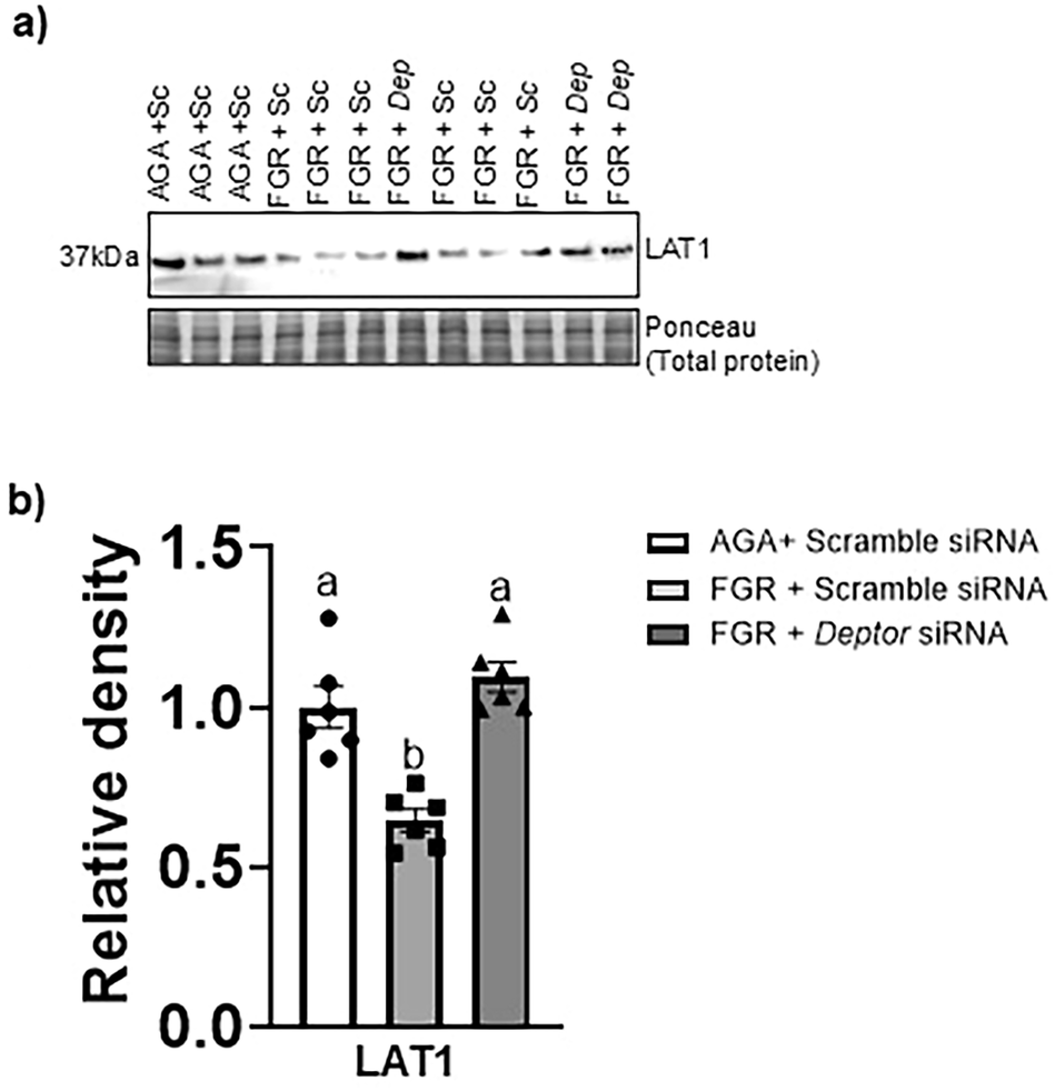 Fig. 8: Normalizing DEPTOR protein level in FGR PHT cells restores the basal plasma membrane (BM) LAT1 expression.