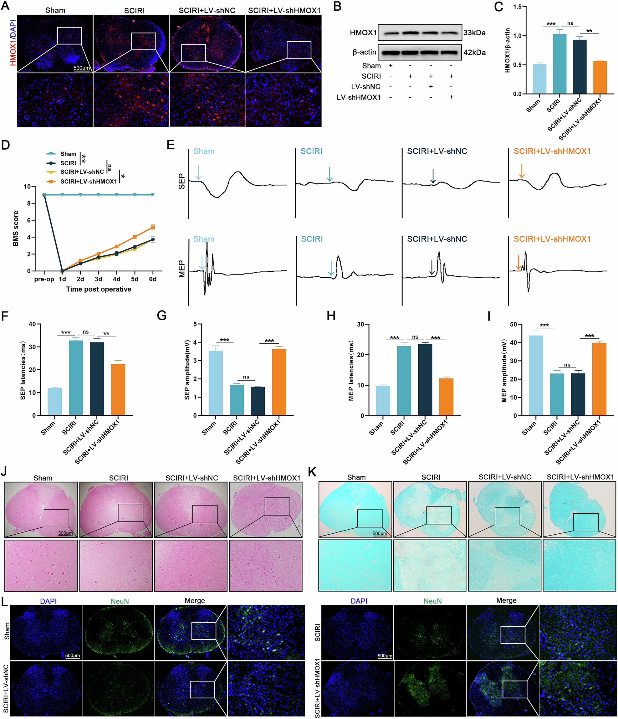 Fig. 7: HMOX1 knockdown promotes neurological function recovery after SCIRI.