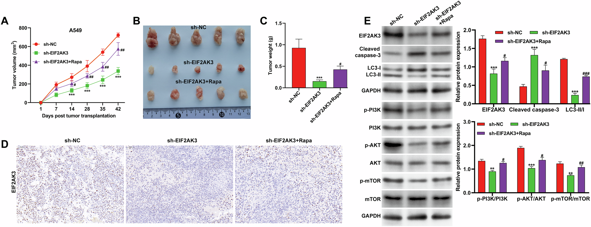 Fig. 7: EIF2AK3 knockdown enhanced DDP efficacy in vivo via autophagy inhibition.