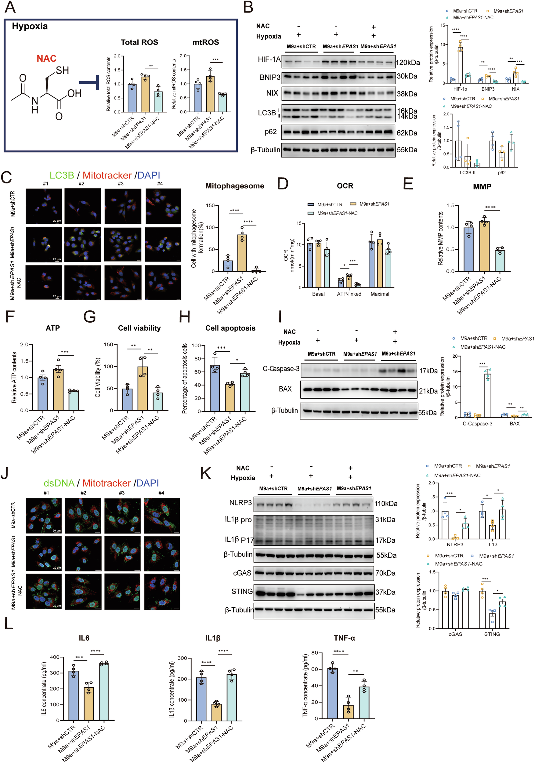 Fig. 5: NAC inhibits HIF-1α stability and BNIP3/NIX-mediated mitophagy, exacerbating mtDNA-mediated inflammation in M9a+shEPAS1 cells during hypoxia.