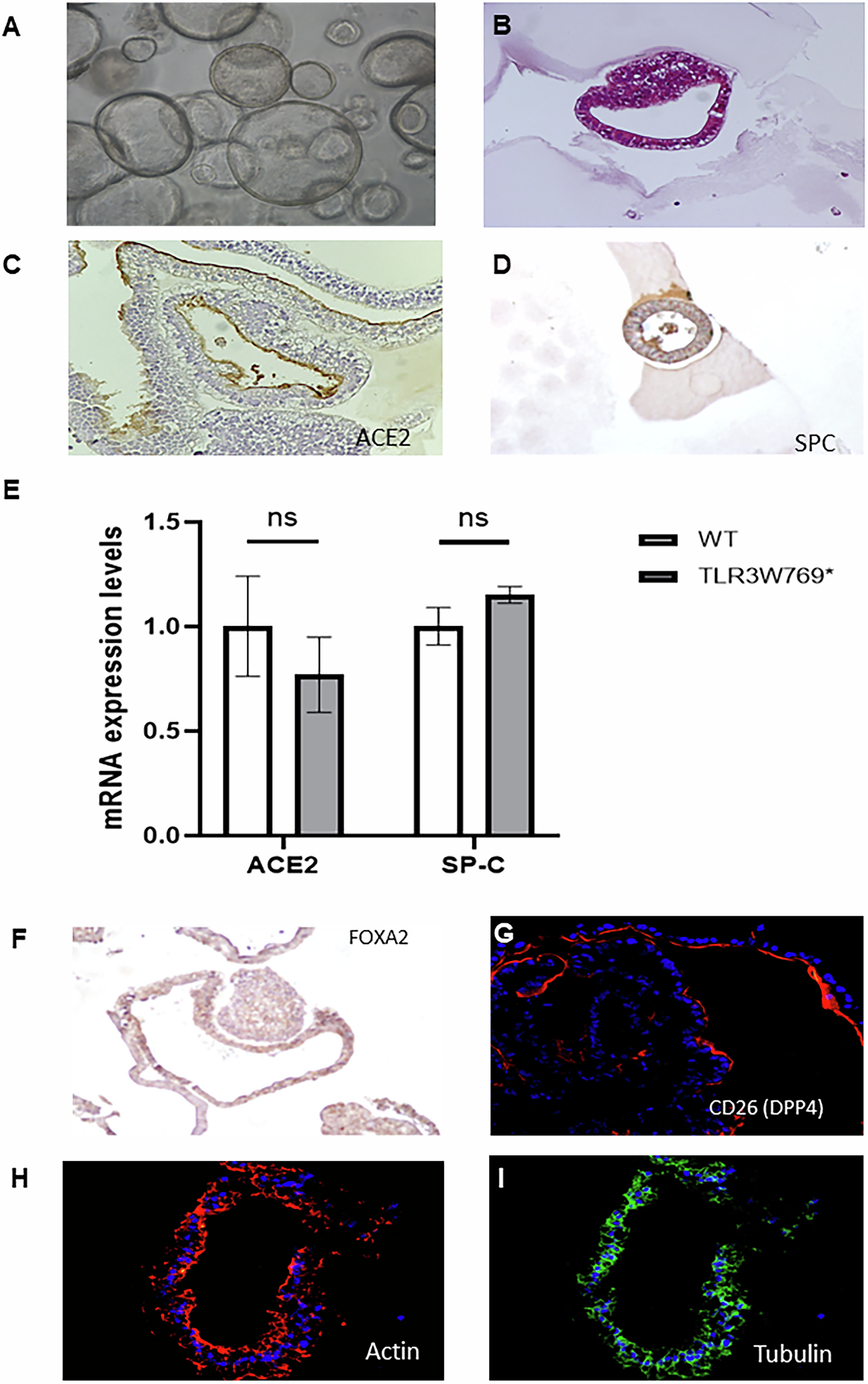 Fig. 3: Characterization of human lung organoids (hLORGs) derived by hiPSCs TLR3W769*.
