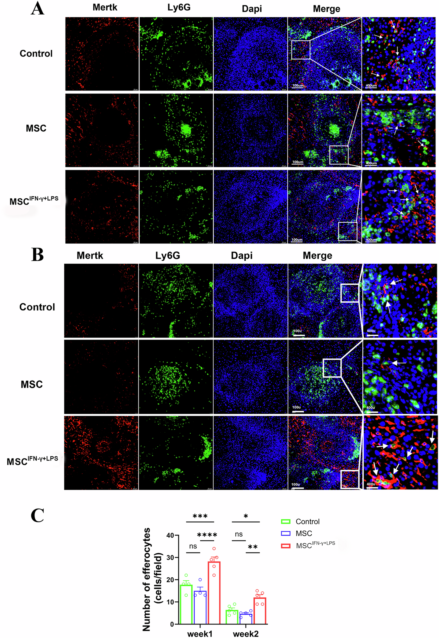 Fig. 5: IFN-γ + LPS -primed MSCs promoted macrophage to phagocytose neutrophils in the liver of infected mice.