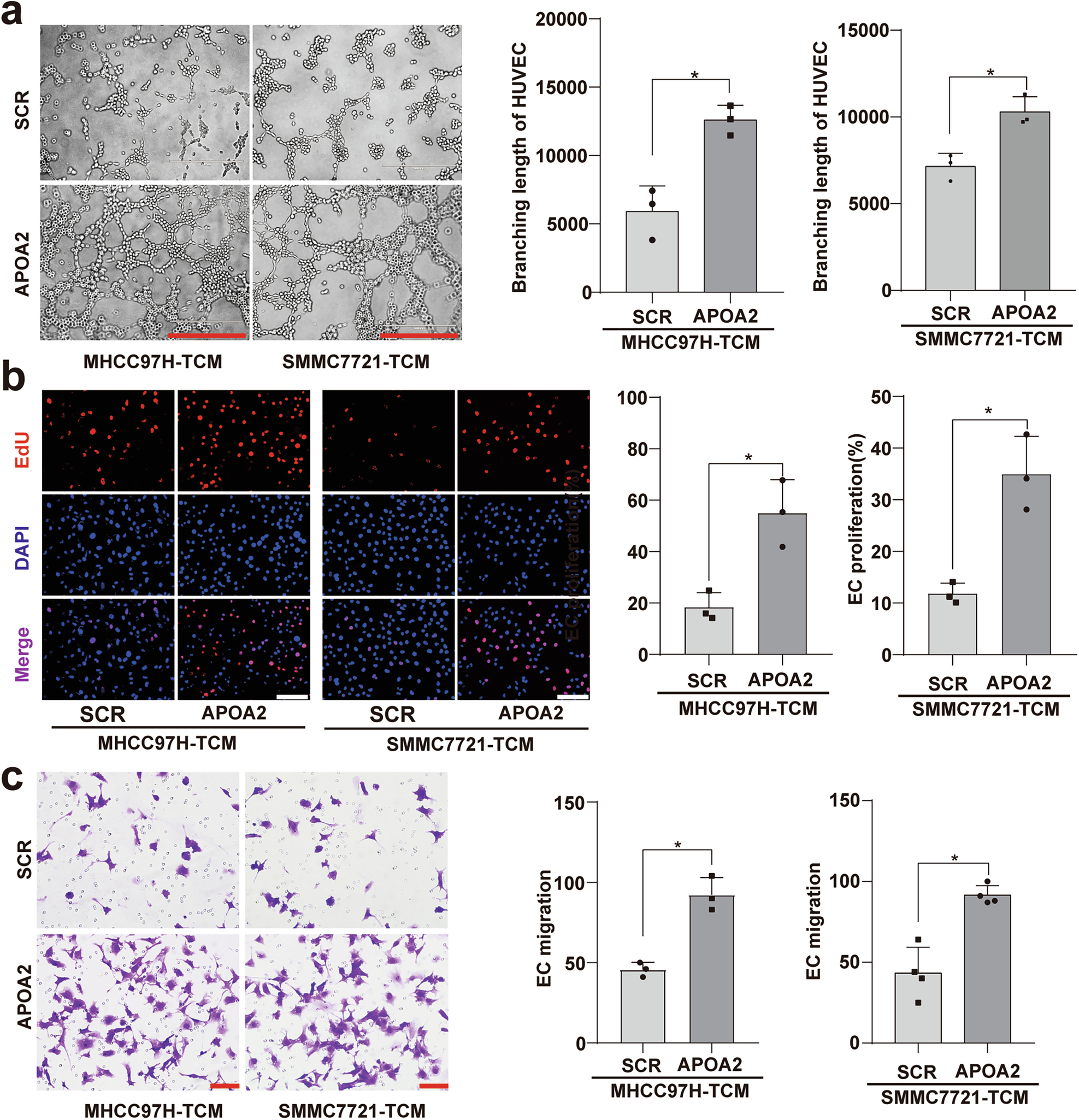 Fig. 5: The conditional medium from HCC cells overexpressing APOA2 on HUVEC proliferation, migration, and tubular formation.