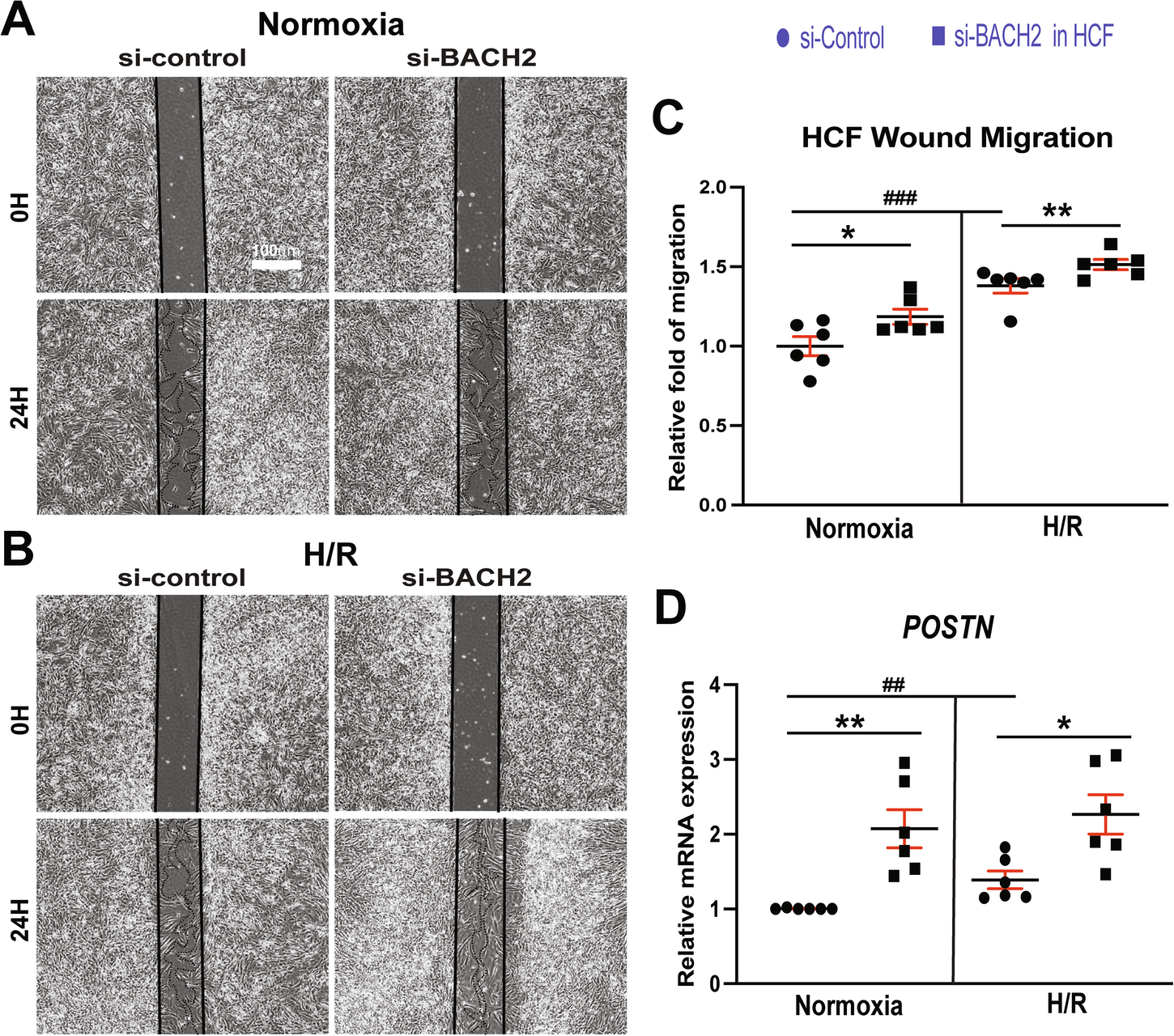 Fig. 6: BACH2 suppresses migration of primary adult human cardiac fibroblasts and inhibits the expression of profibrotic POSTN.