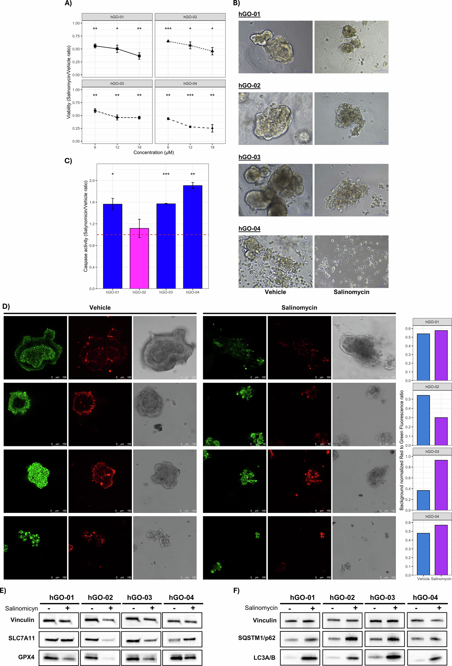 Fig. 9: Effectiveness of Salinomycin on human Gastric Organoids (hGOs).