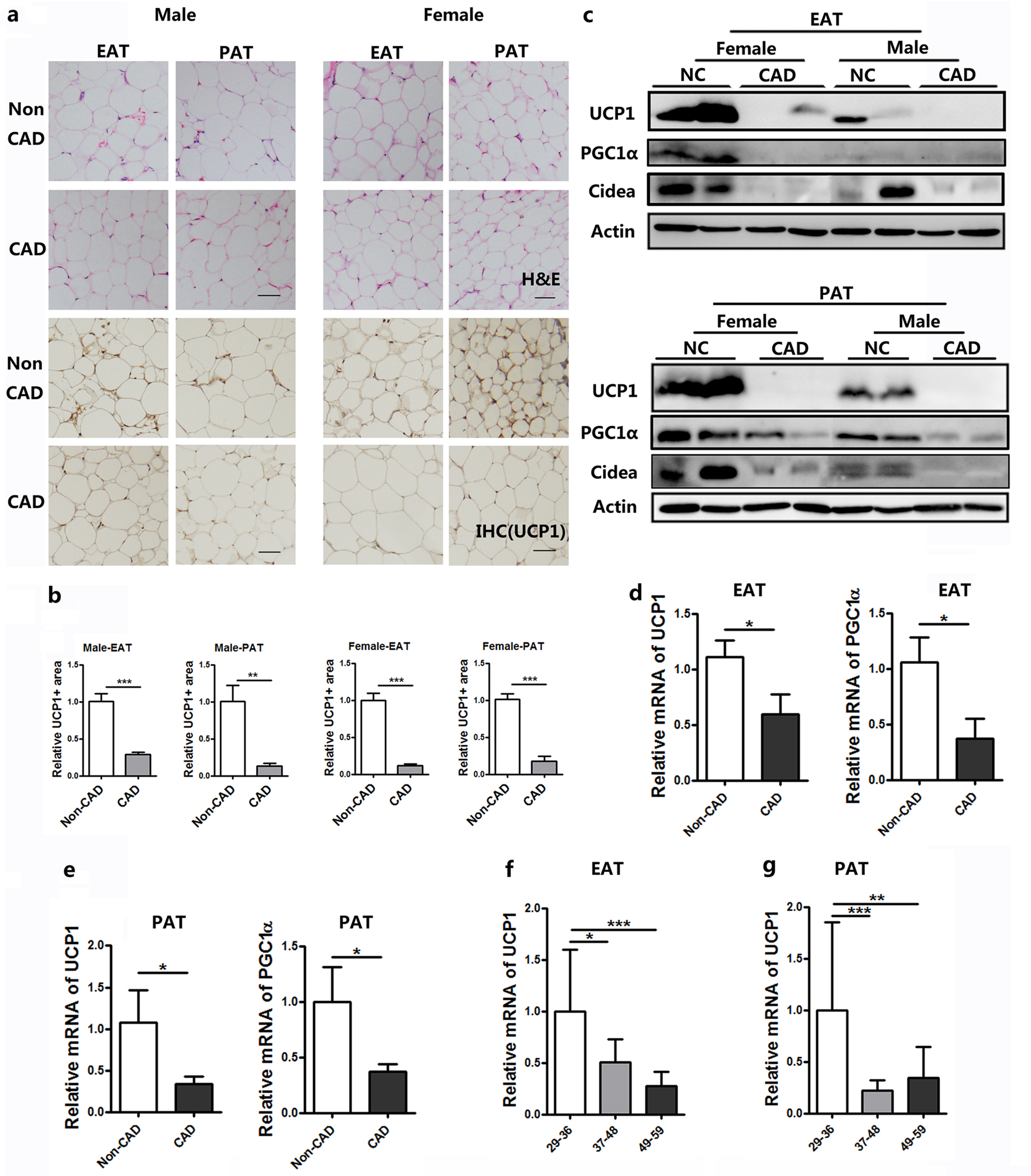 Fig. 2: UCP1 expressions in human pericardial adipose tissue from patients with vs. without CAD.