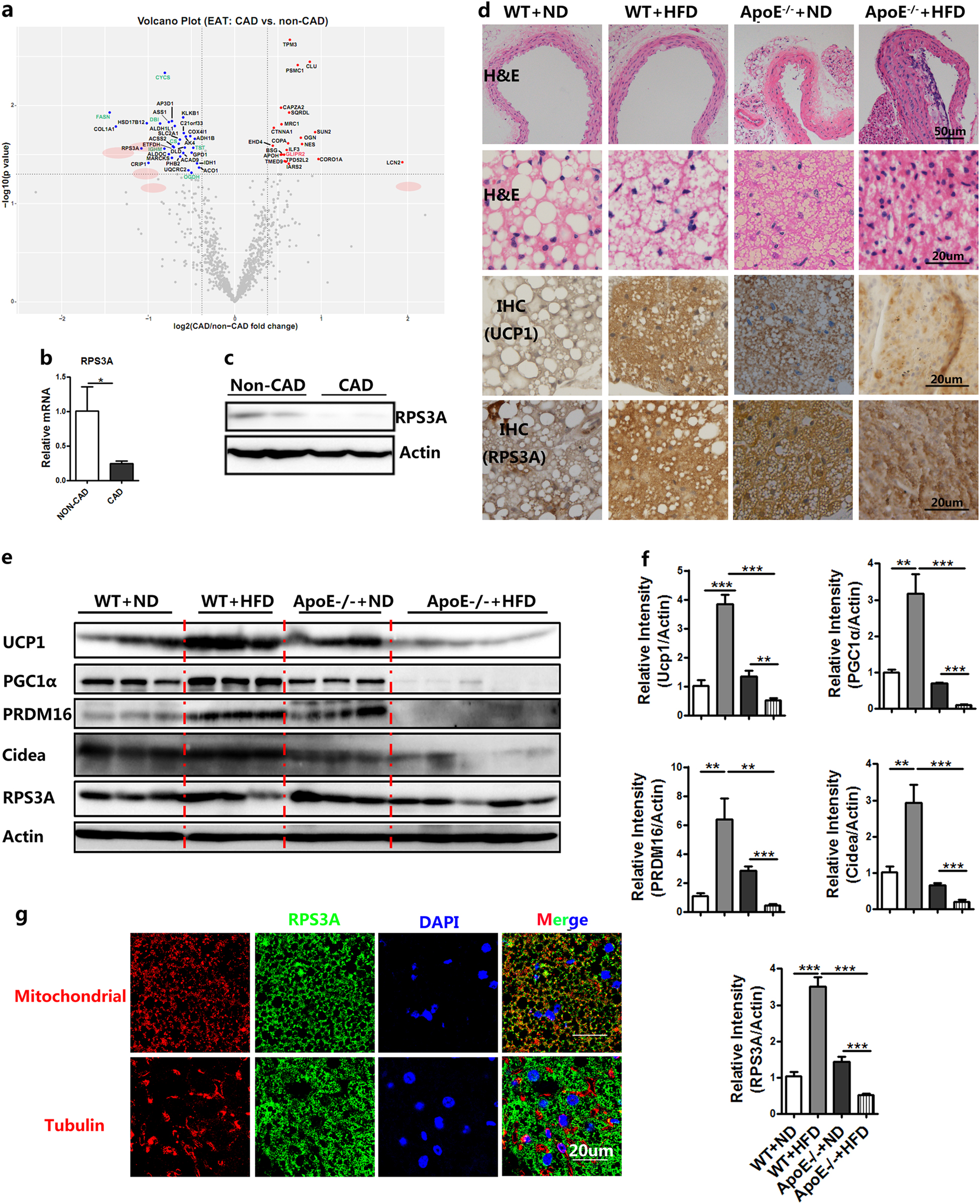 Fig. 4: The expression of RPS3A is decreased in perivascular adipose tissue to inhibit stem cell adipogenesis.