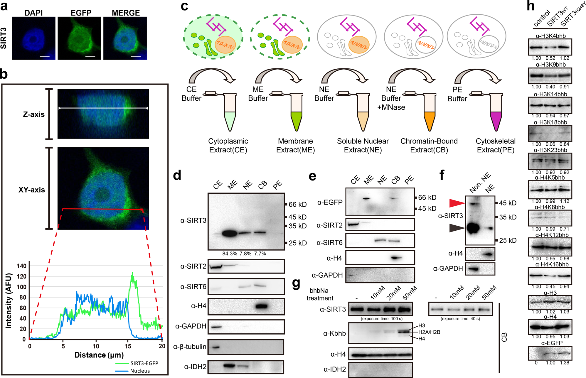 Fig. 6: SIRT3 regulates histone Kbhb levels in a class-selective manner in nucleus.