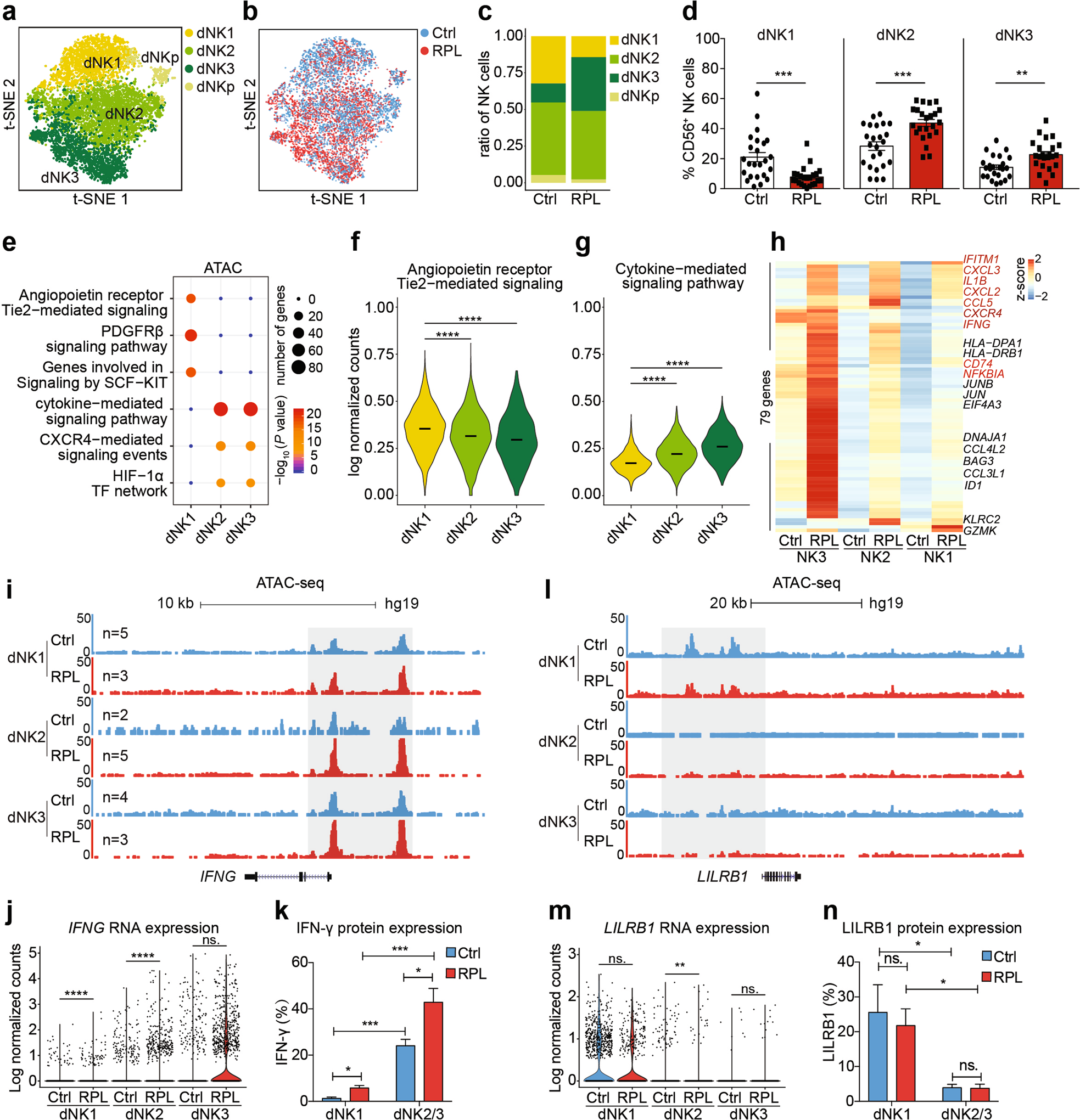Fig. 2: A subset of angiogenic dNK cells are decreased in RPL patients.