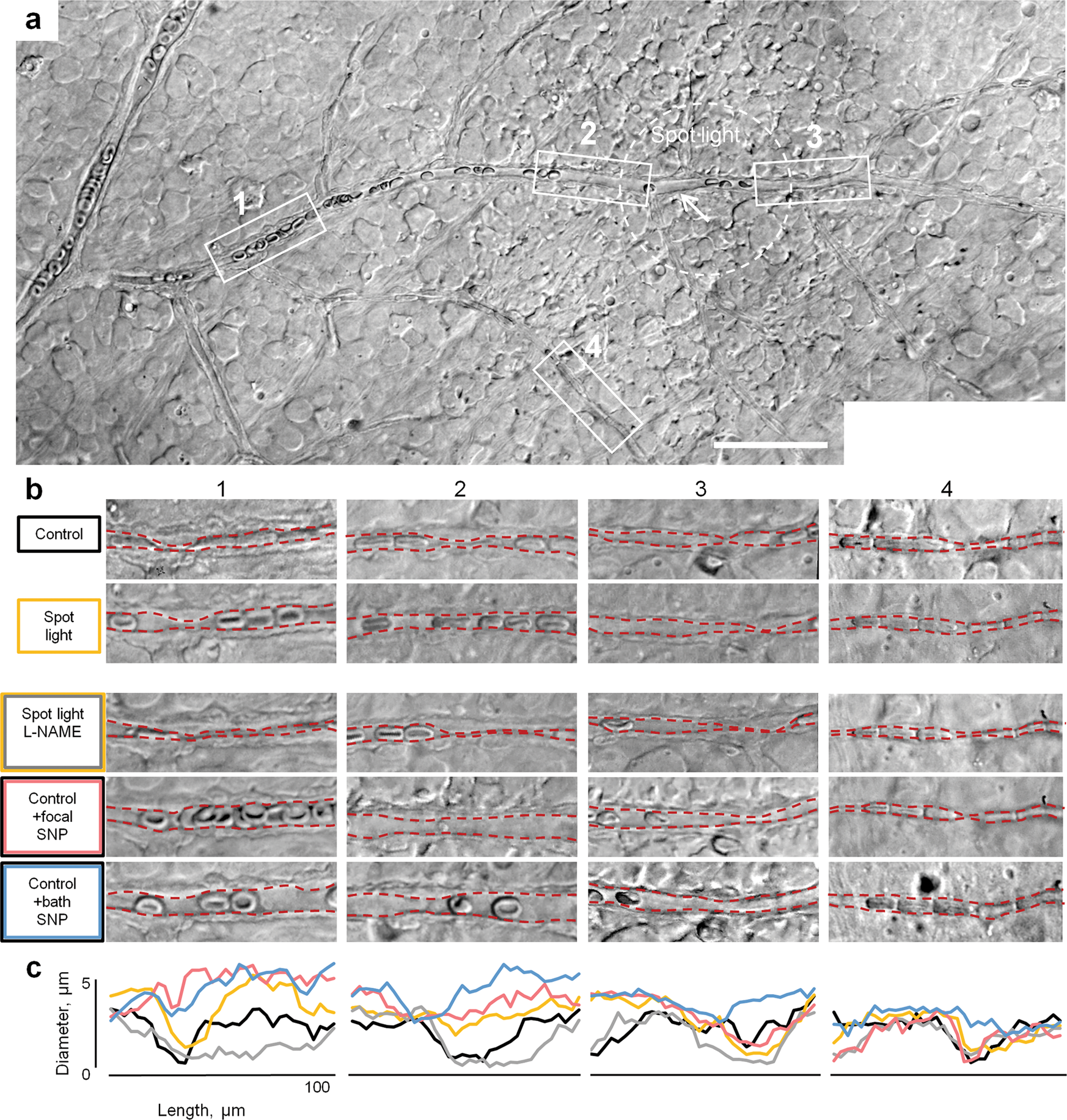 Fig. 4: Directionality of light-induced vasodilation is driven by local, but not global NO signaling.