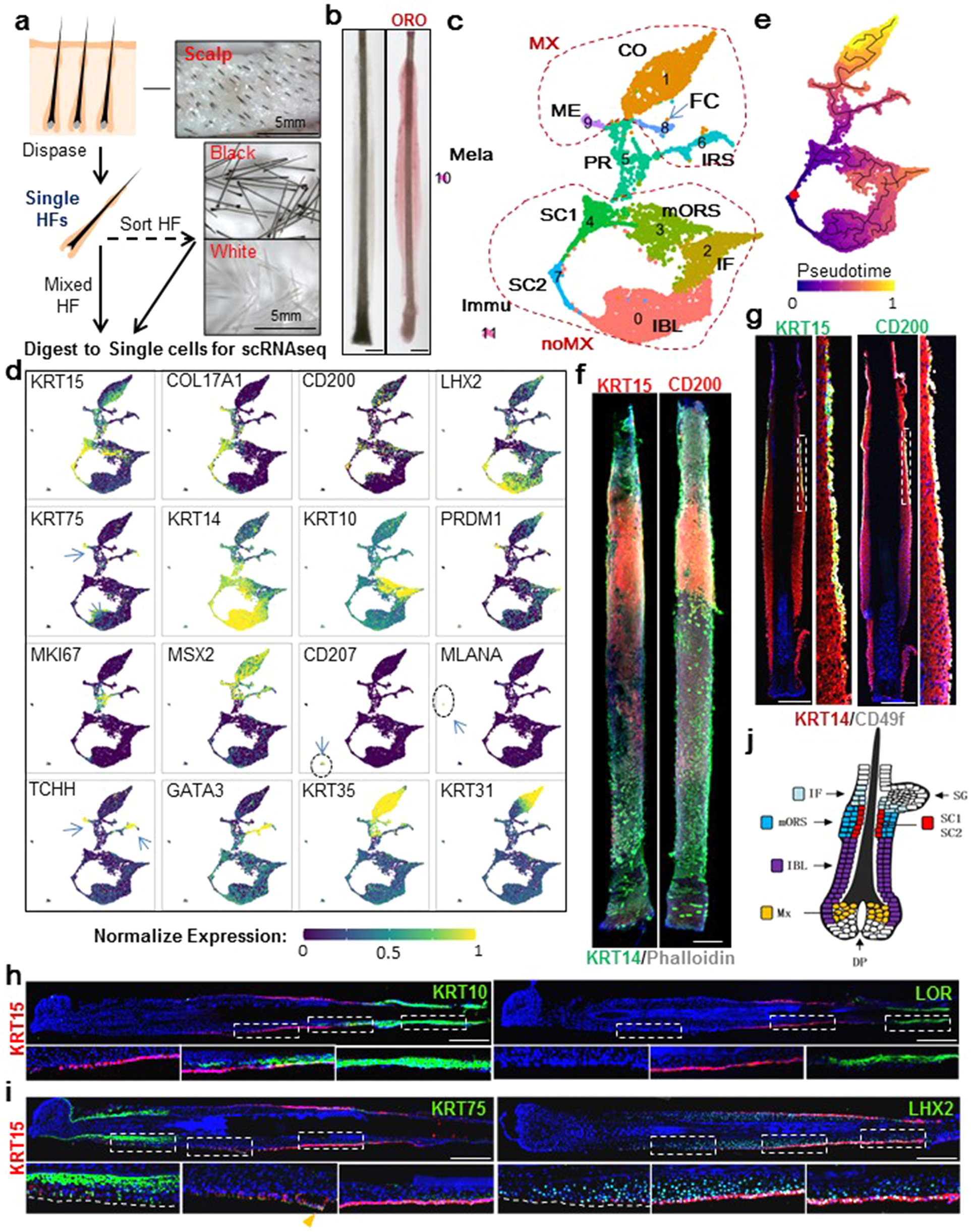 Single-cell transcriptomics reveals lineage trajectory of human scalp hair  follicle and informs mechanisms of hair graying | Cell Discovery