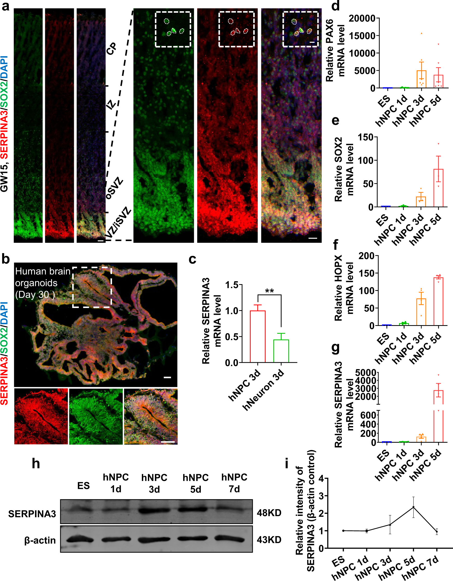 Fig. 1: SERPINA3 is expressed in VZ/SVZ of human brain.
