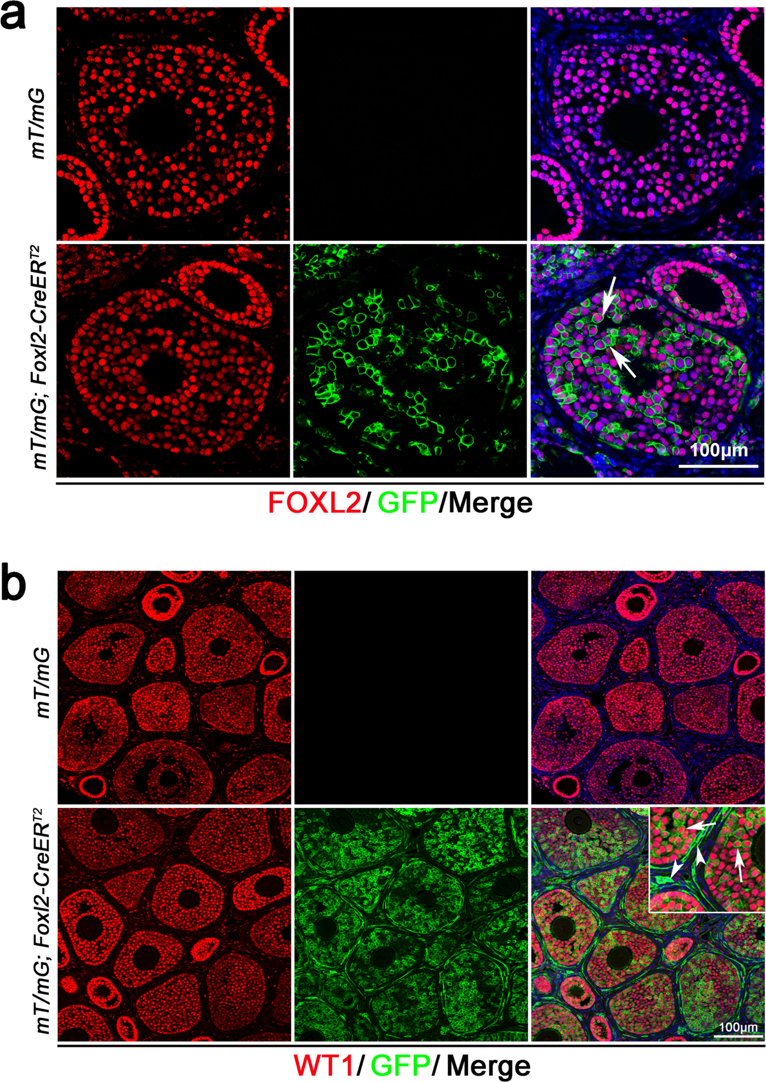 Fig. 2: Lineage tracing of Foxl2-expressing cells in the fetal ovary with Foxl2-CreERT2 mice.