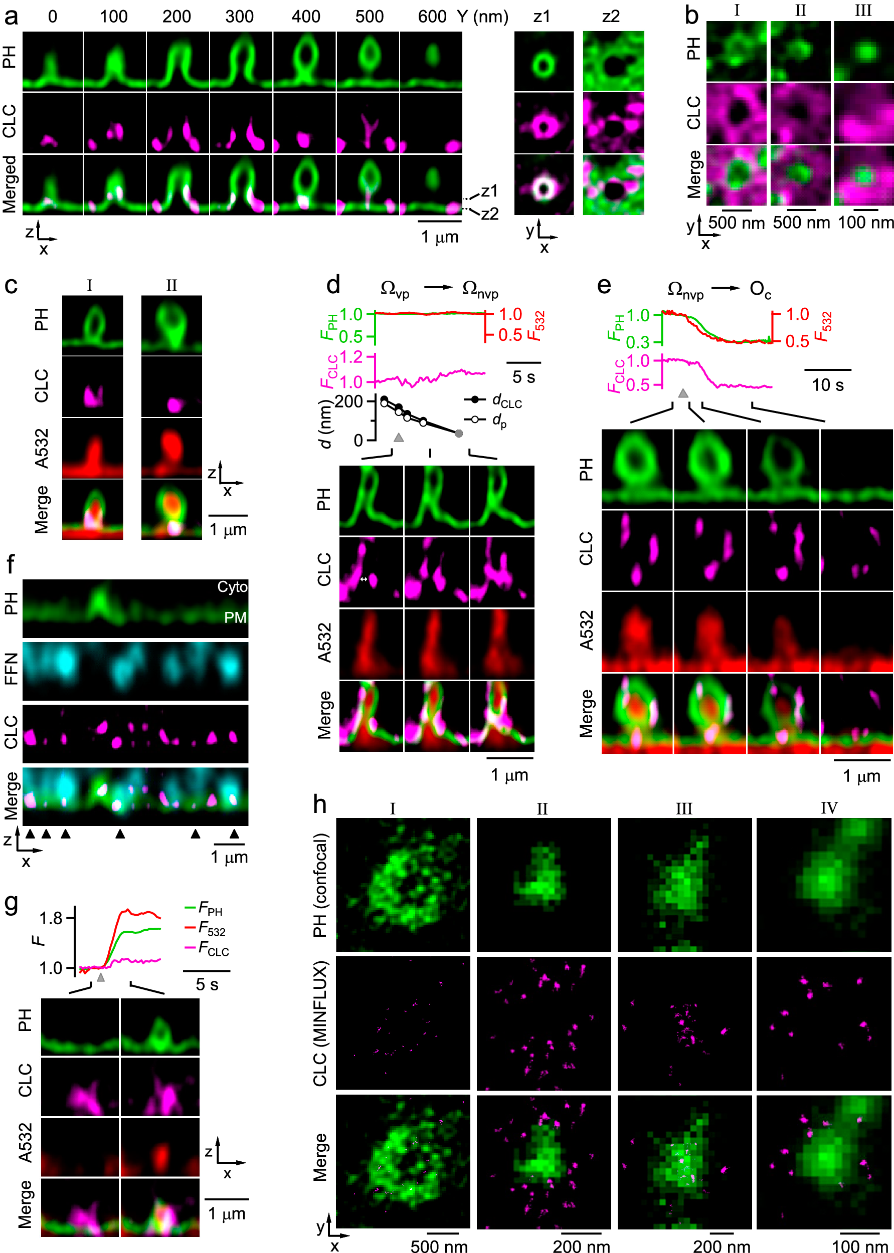 Fig. 2: Clathrin at Ω-profile’s base/pore region constricts the pore.