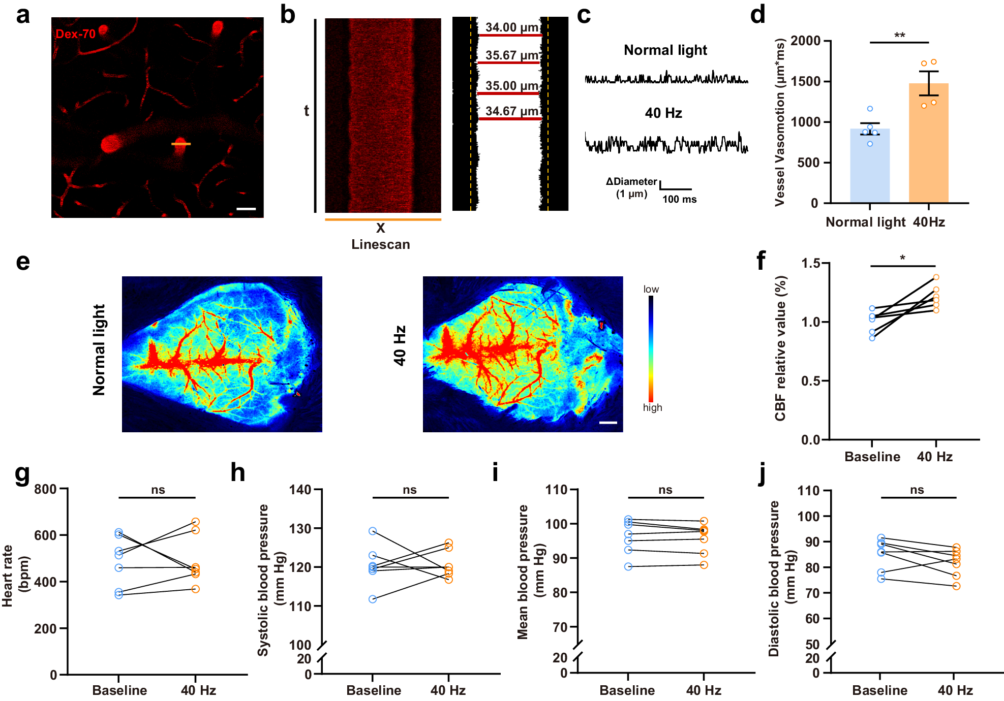 Fig. 5: 40 Hz light flickering enhances the glymphatic influx through increased arterial vasomotion.