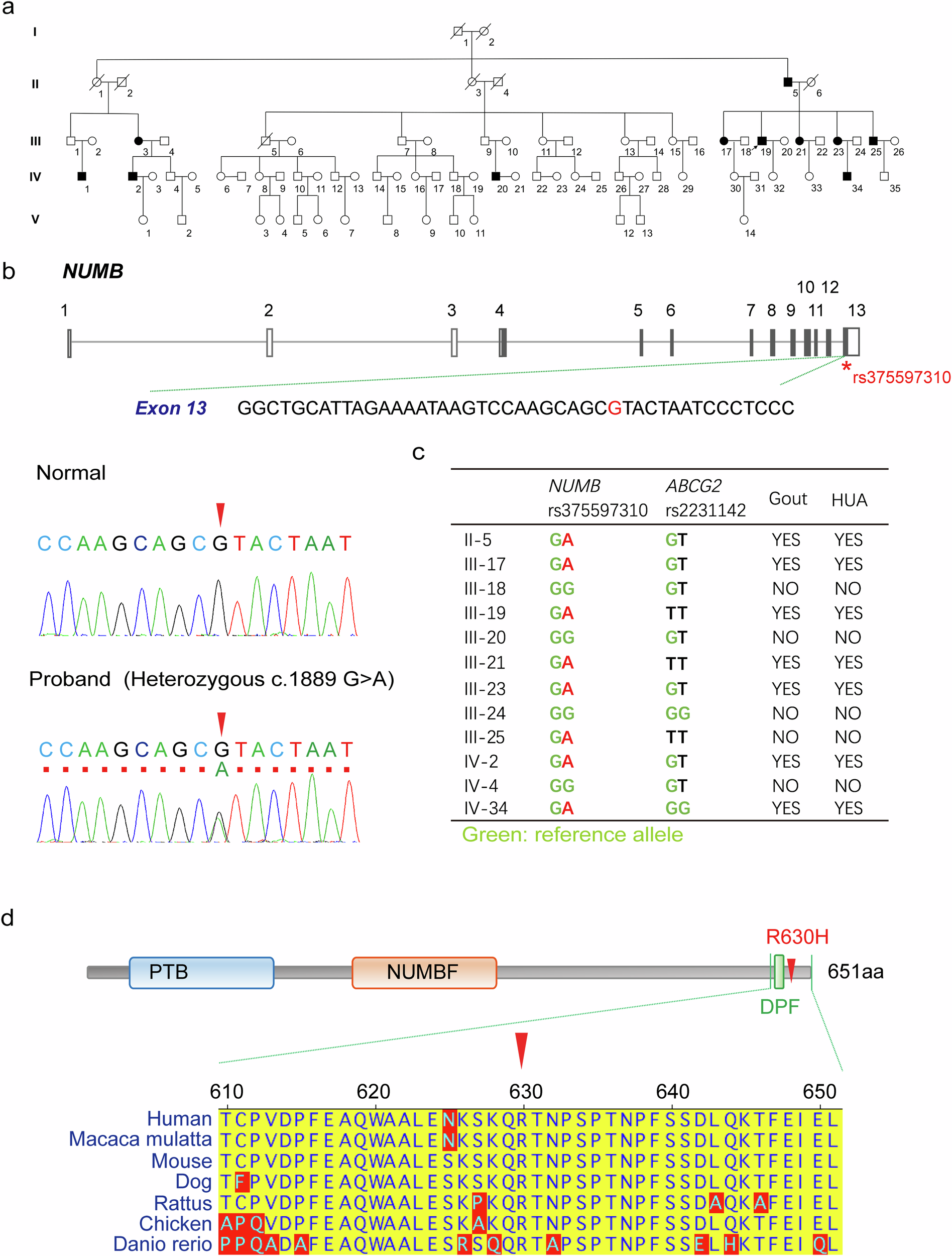 Fig. 1: Genetic alteration of NUMB gene in patients with inherent hyperuricemia and gout.